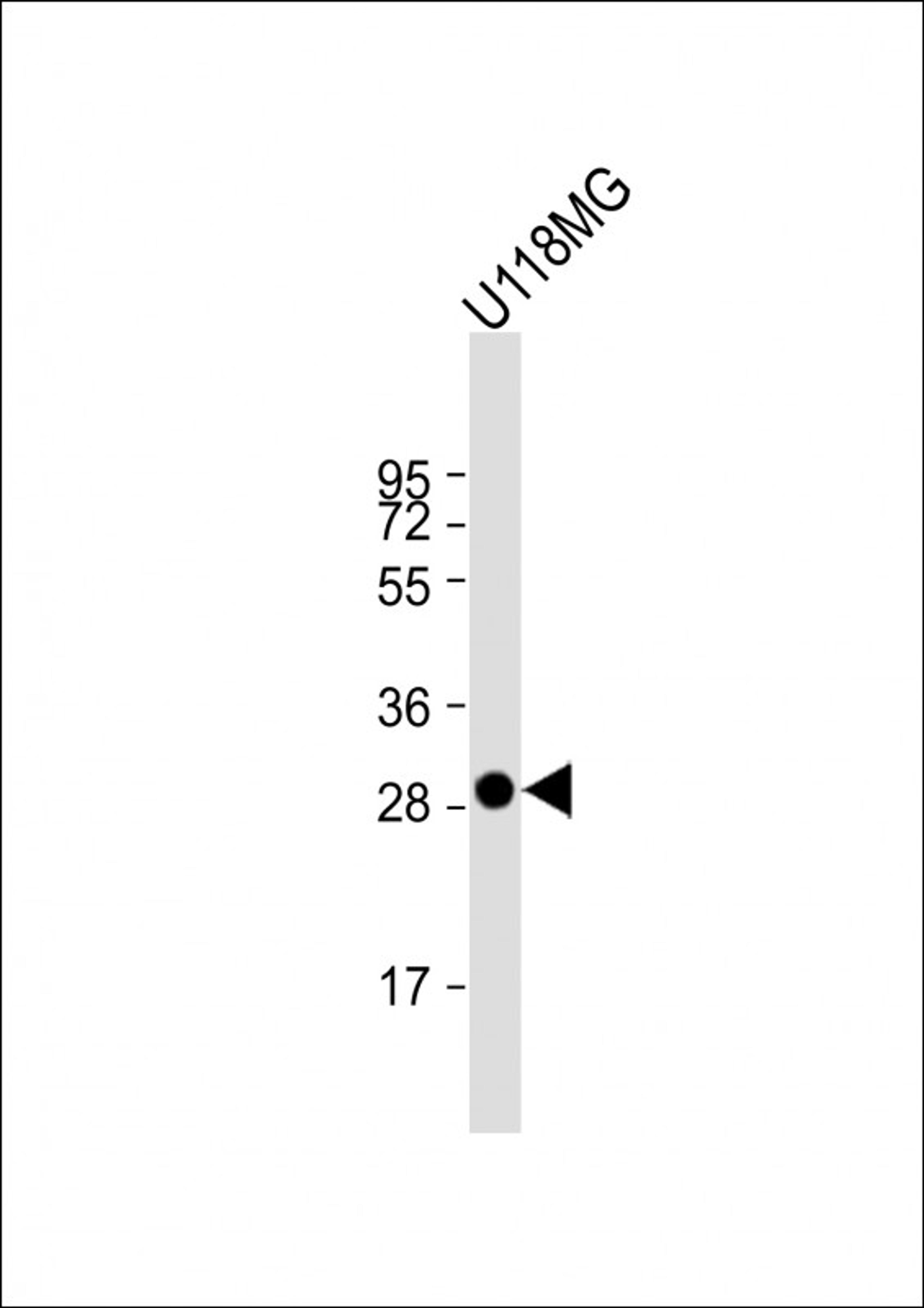 Western Blot at 1:1000 dilution + U118MG whole cell lysate Lysates/proteins at 20 ug per lane.