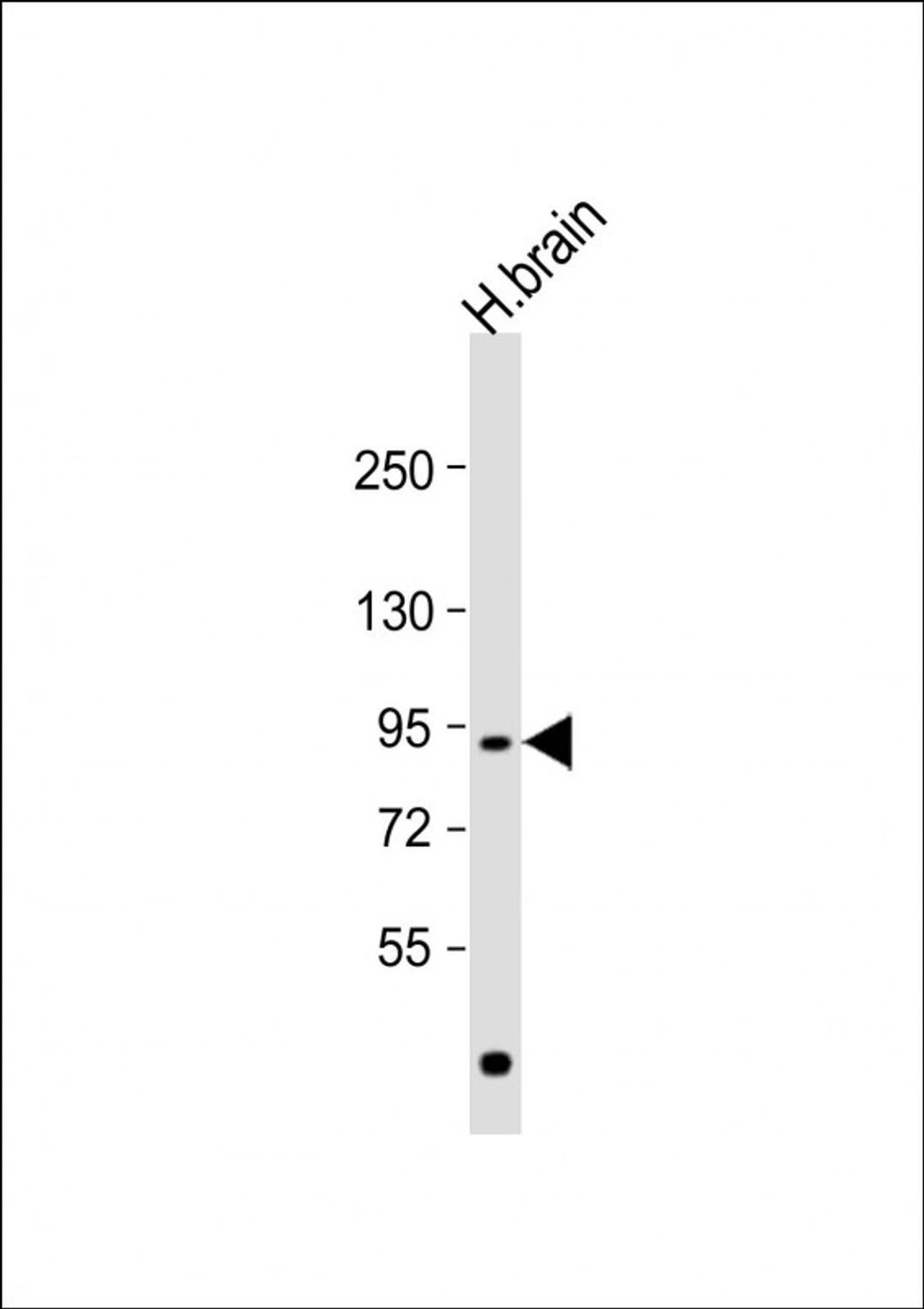 Western Blot at 1:1000 dilution + human brain lysate Lysates/proteins at 20 ug per lane.