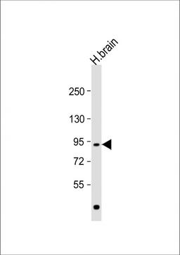 Western Blot at 1:1000 dilution + human brain lysate Lysates/proteins at 20 ug per lane.