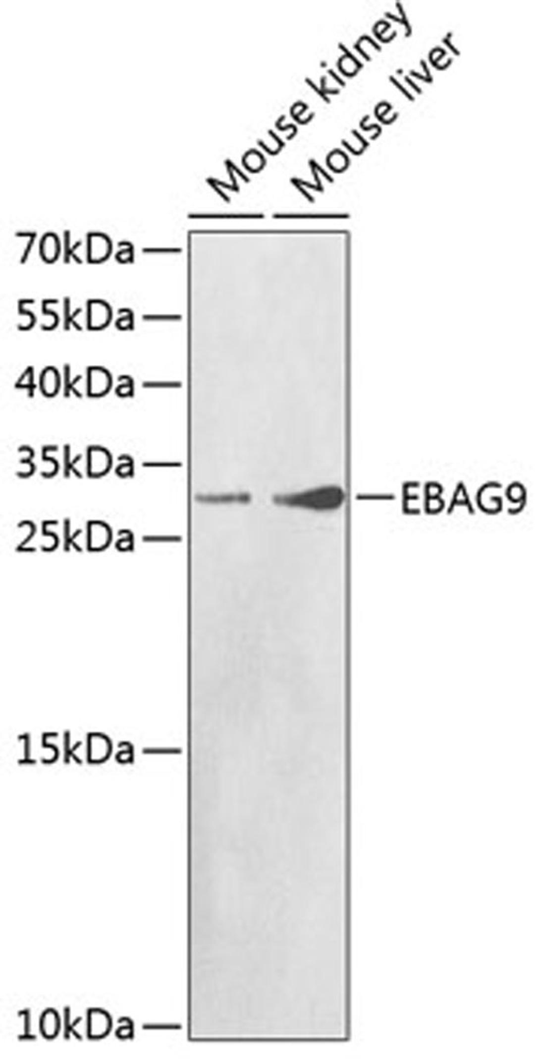 Western blot - EBAG9 antibody (A1935)