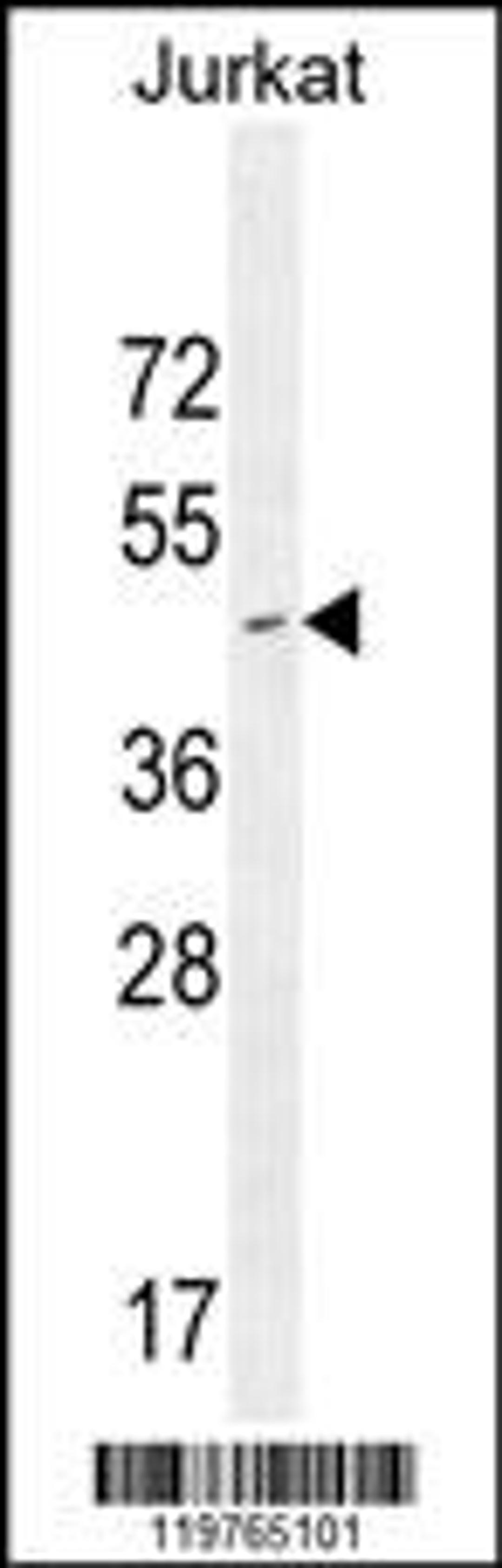 Western blot analysis in Jurkat cell line lysates (35ug/lane).