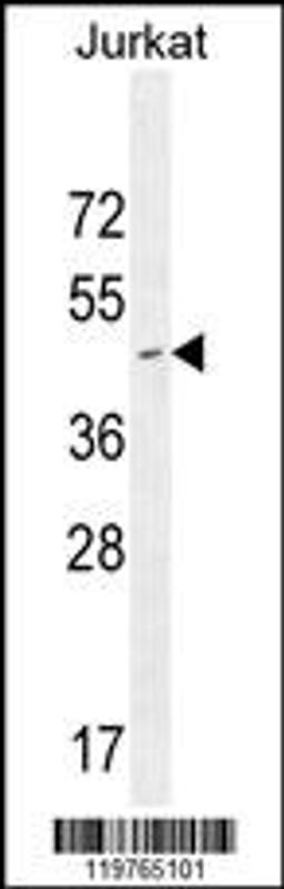 Western blot analysis in Jurkat cell line lysates (35ug/lane).