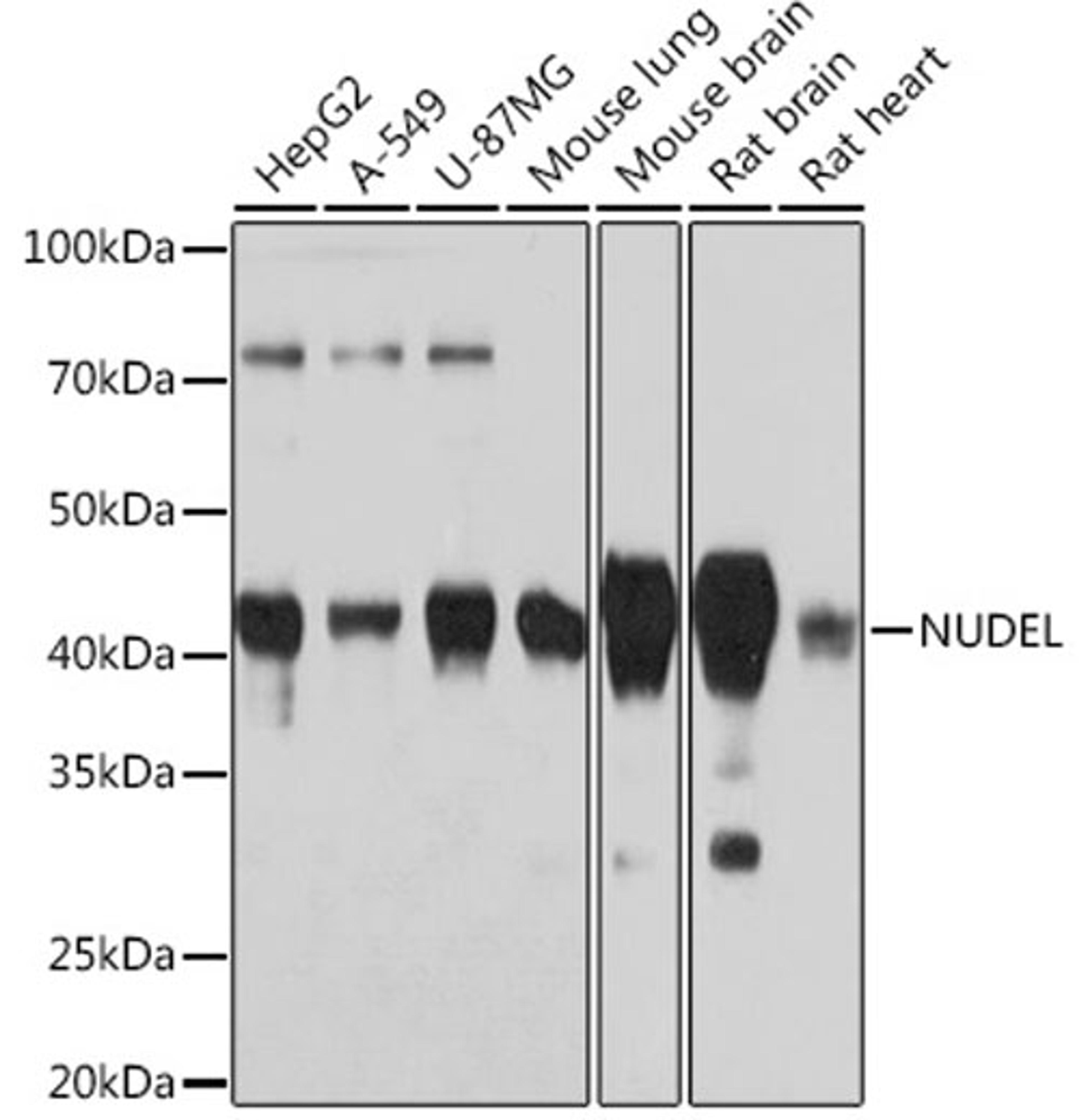 Western blot - NUDEL Rabbit mAb (A3799)