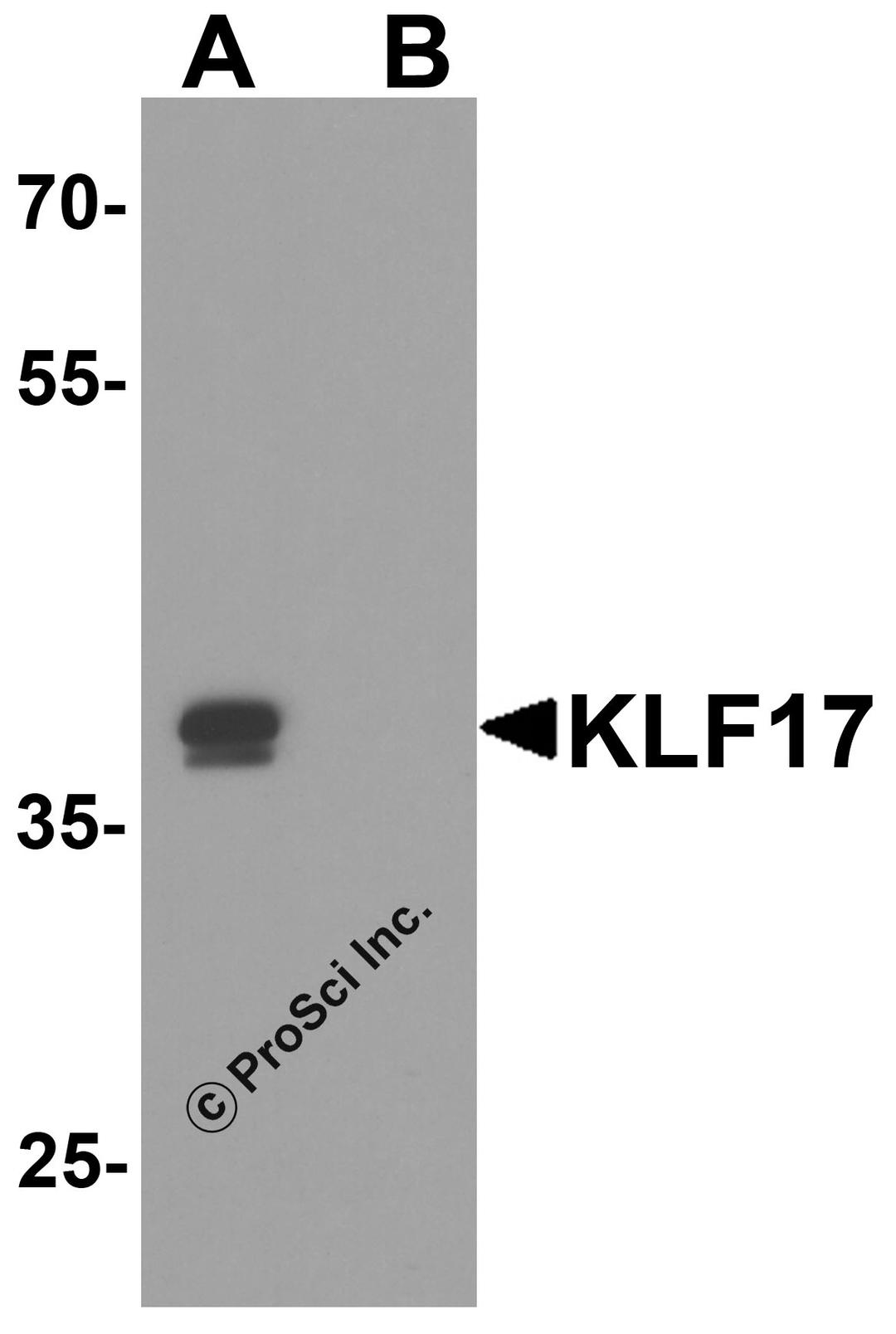 Western blot analysis of KLF17 in rat liver tissue lysate with KLF17 antibody at 1 μg/ml in (A) the absence and (B) the presence of blocking peptide.