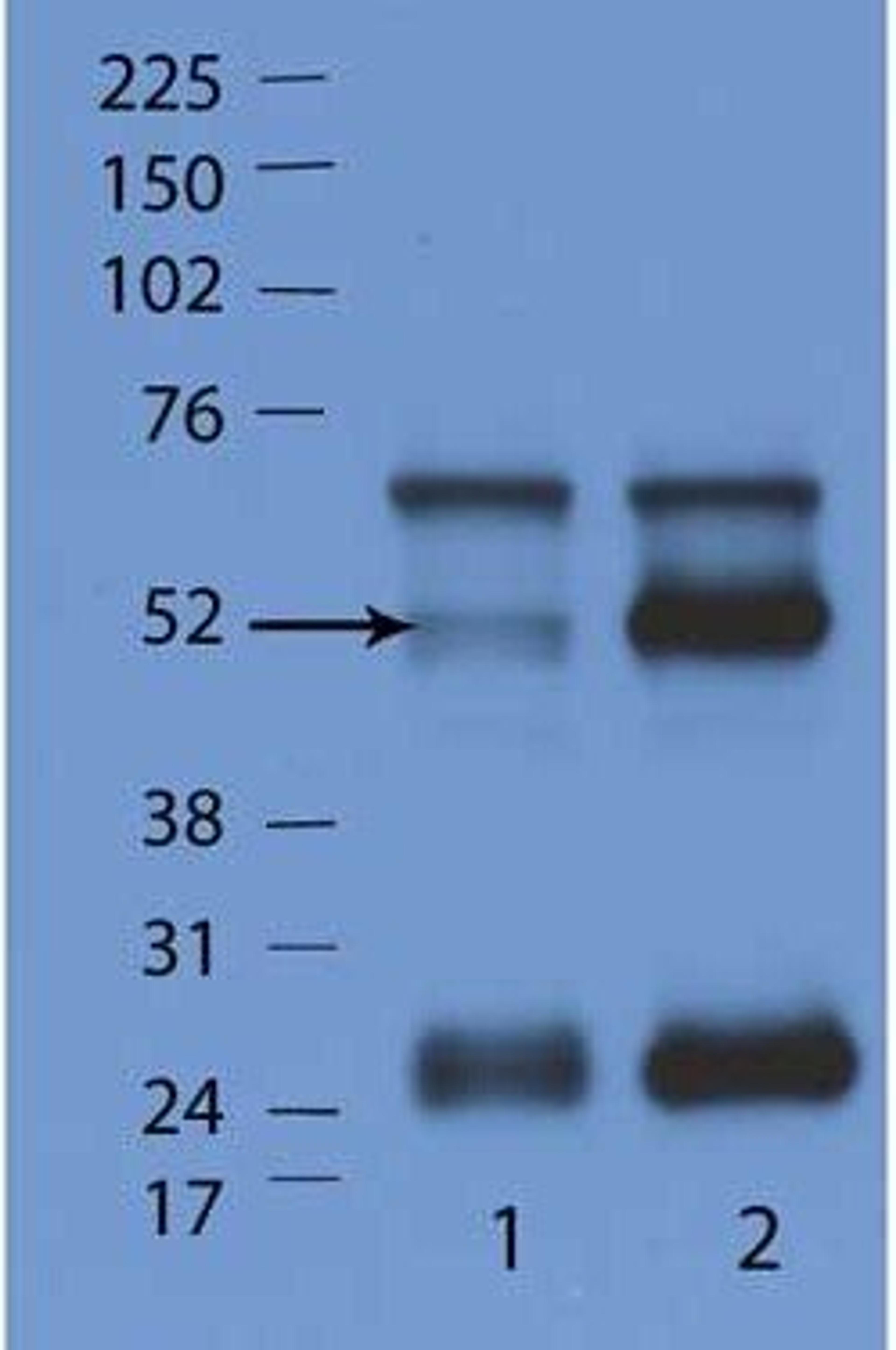 Western blot analysis of WT mouse (Lane1) and IFN gamma gene KO mouse (Lane2) using IFN Induced GTPase-like Protein antibody