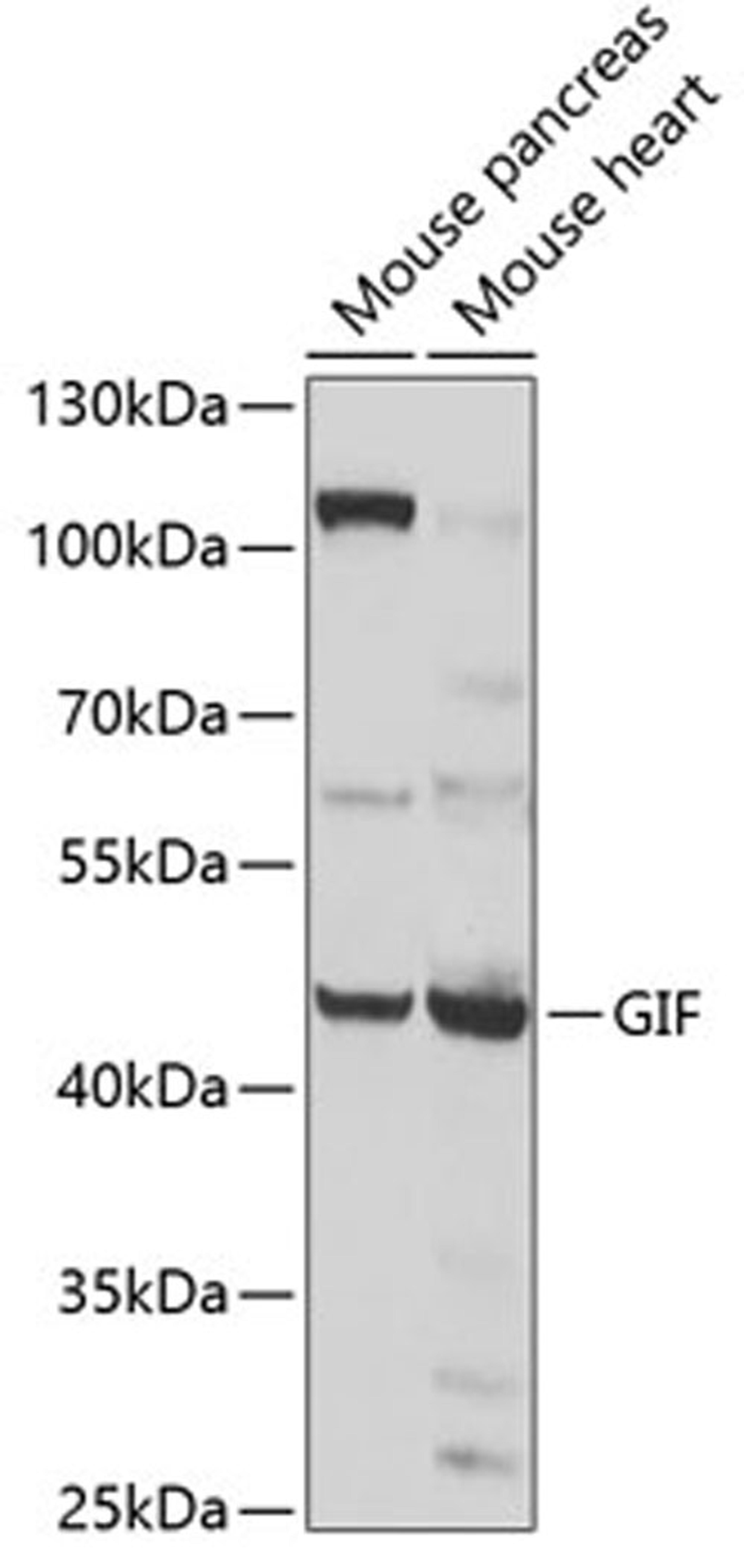 Western blot - GIF antibody (A6914)