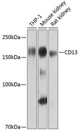 Western blot - CD13 Rabbit mAb (A11669)