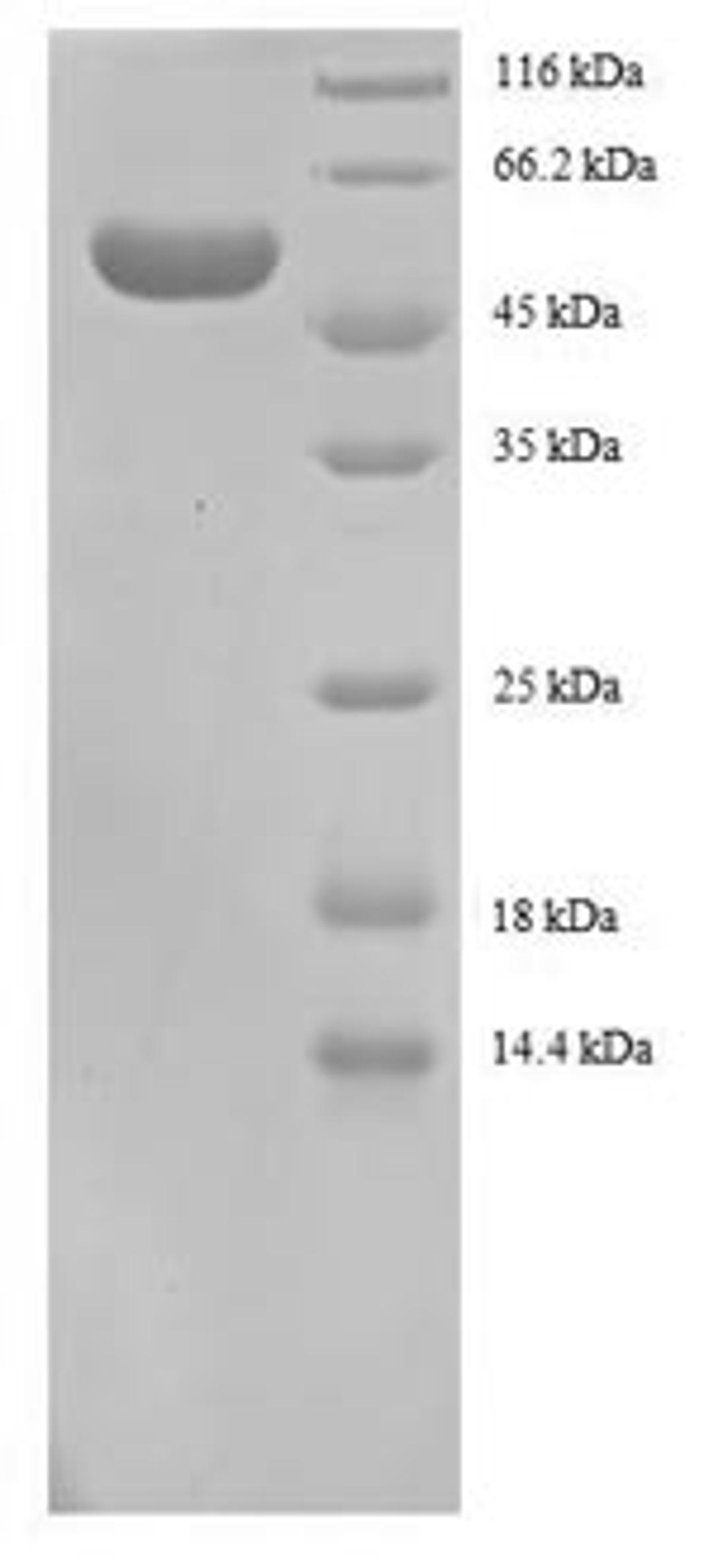 (Tris-Glycine gel) Discontinuous SDS-PAGE (reduced) with 5% enrichment gel and 15% separation gel.