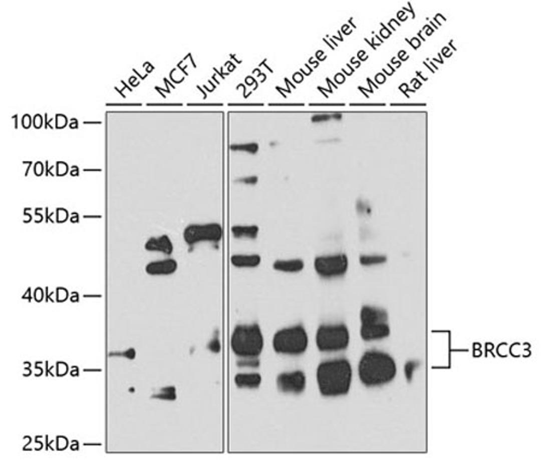 Western blot - BRCC3 antibody (A7995)