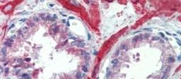 Immunohistochemistry-Paraffin: IGFBP-4 Antibody [NBP1-80549] - Human Prostate Tissue, 5.0ug/ml.