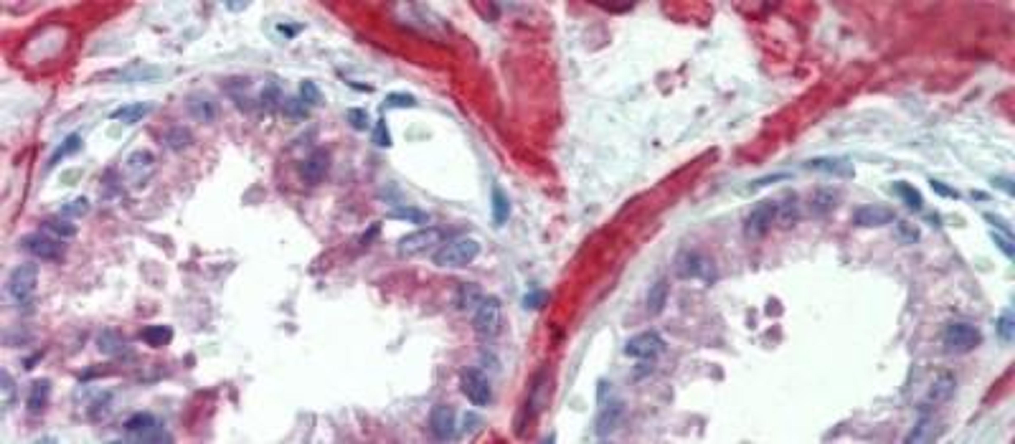 Immunohistochemistry-Paraffin: IGFBP-4 Antibody [NBP1-80549] - Human Prostate Tissue, 5.0ug/ml.