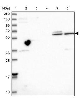 Western Blot: ZNF584 Antibody [NBP2-47564] - Lane 1: Marker [kDa] 250, 130, 95, 72, 55, 36, 28, 17, 10.  Lane 2: Human cell line RT-4.  Lane 3: Human cell line U-251MG.  Lane 4: Human plasma (IgG/HSA depleted).  Lane 5: Human liver tissue.  Lane 6: Human tonsil tissue.