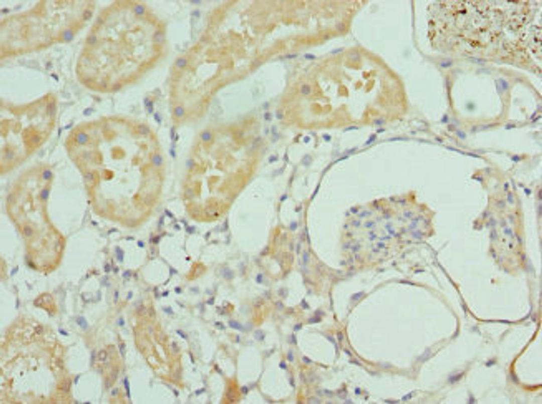 Immunohistochemistry of paraffin-embedded human kidney tissue using CSB-PA011758ESR2HU at dilution of 1:100
