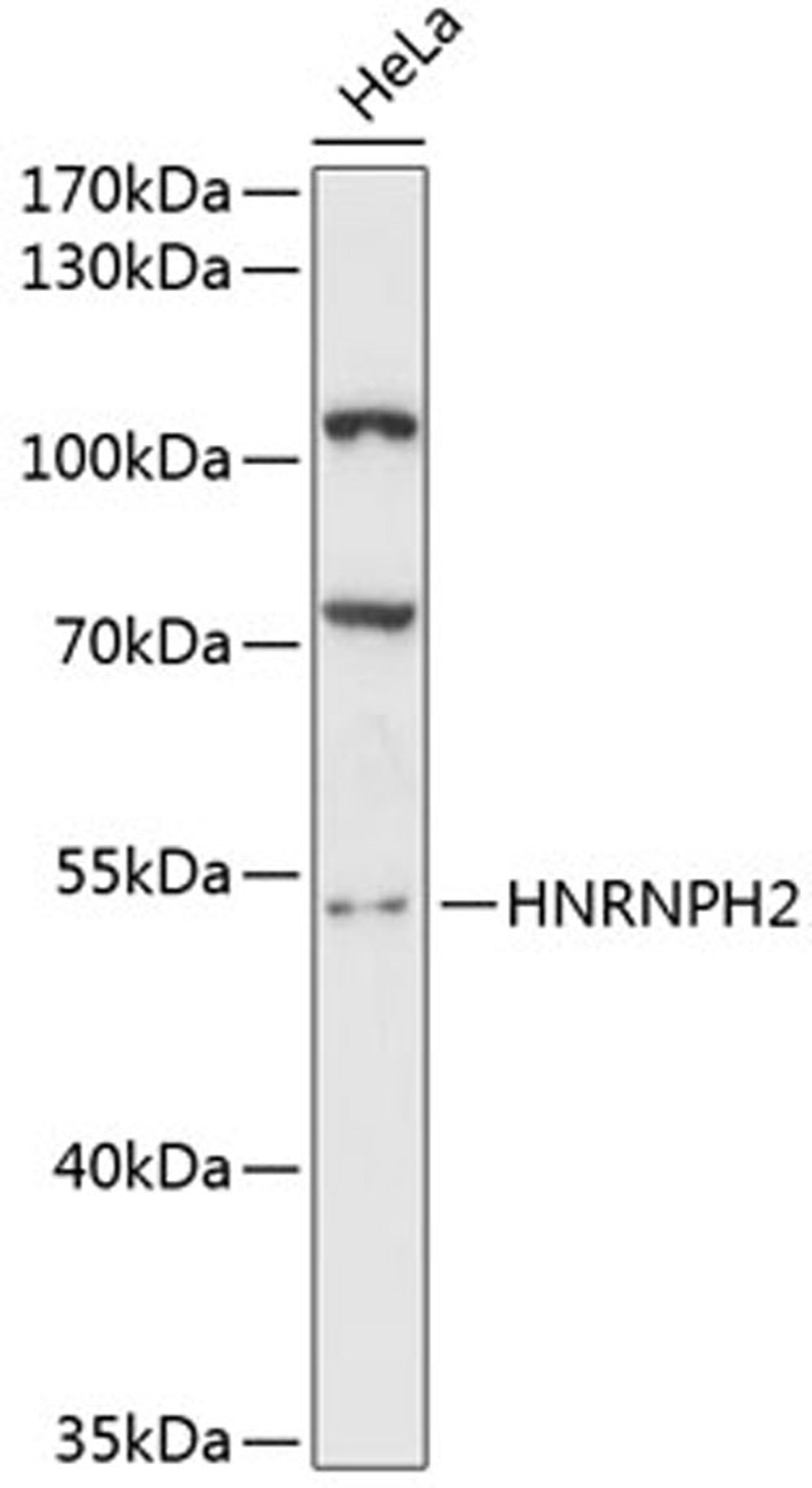 Western blot - HNRNPH2 antibody (A12993)