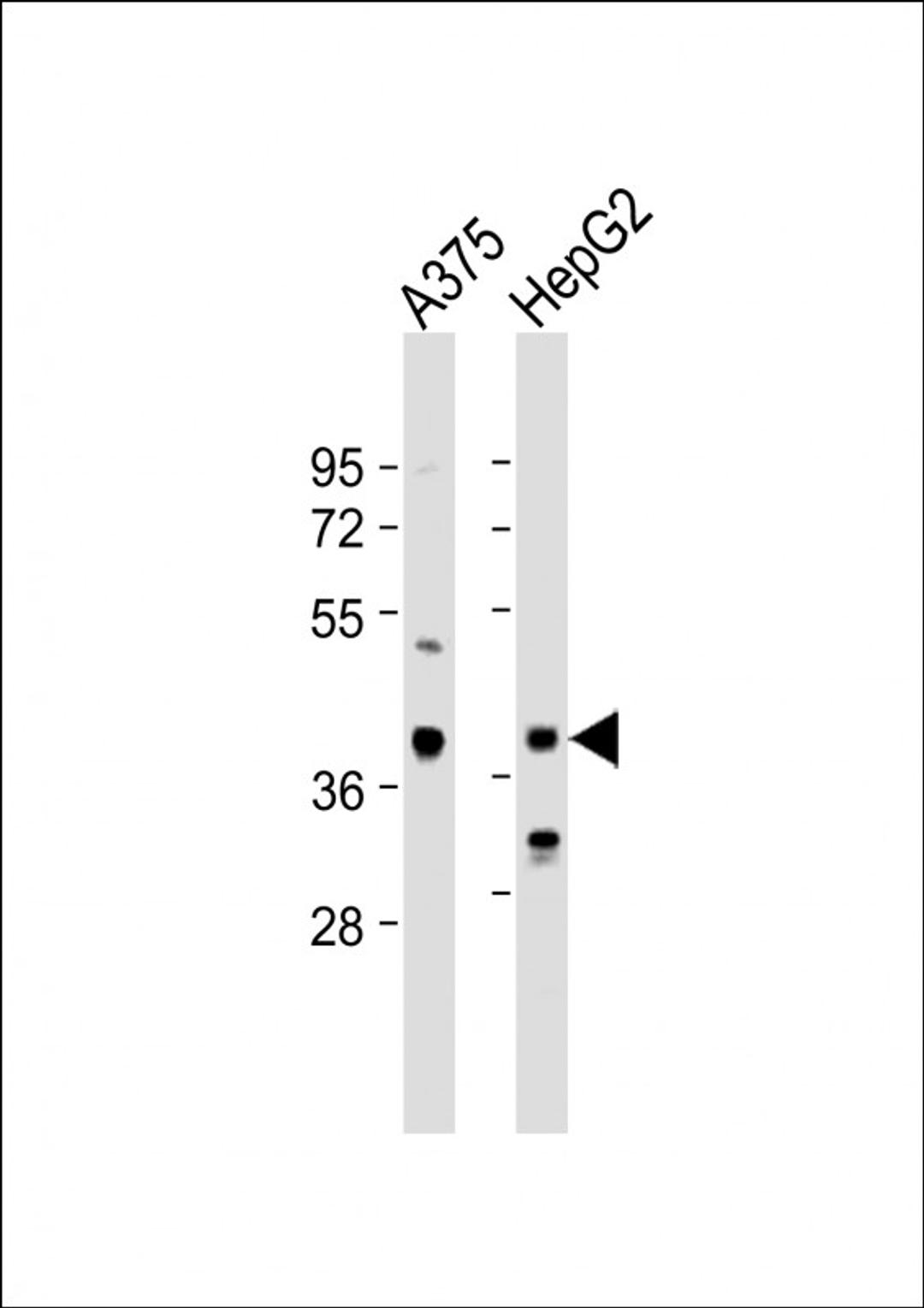 Western Blot at 1:1000 dilution Lane 1: A375 whole cell lysate Lane 2: HepG2 whole cell lysate Lysates/proteins at 20 ug per lane.