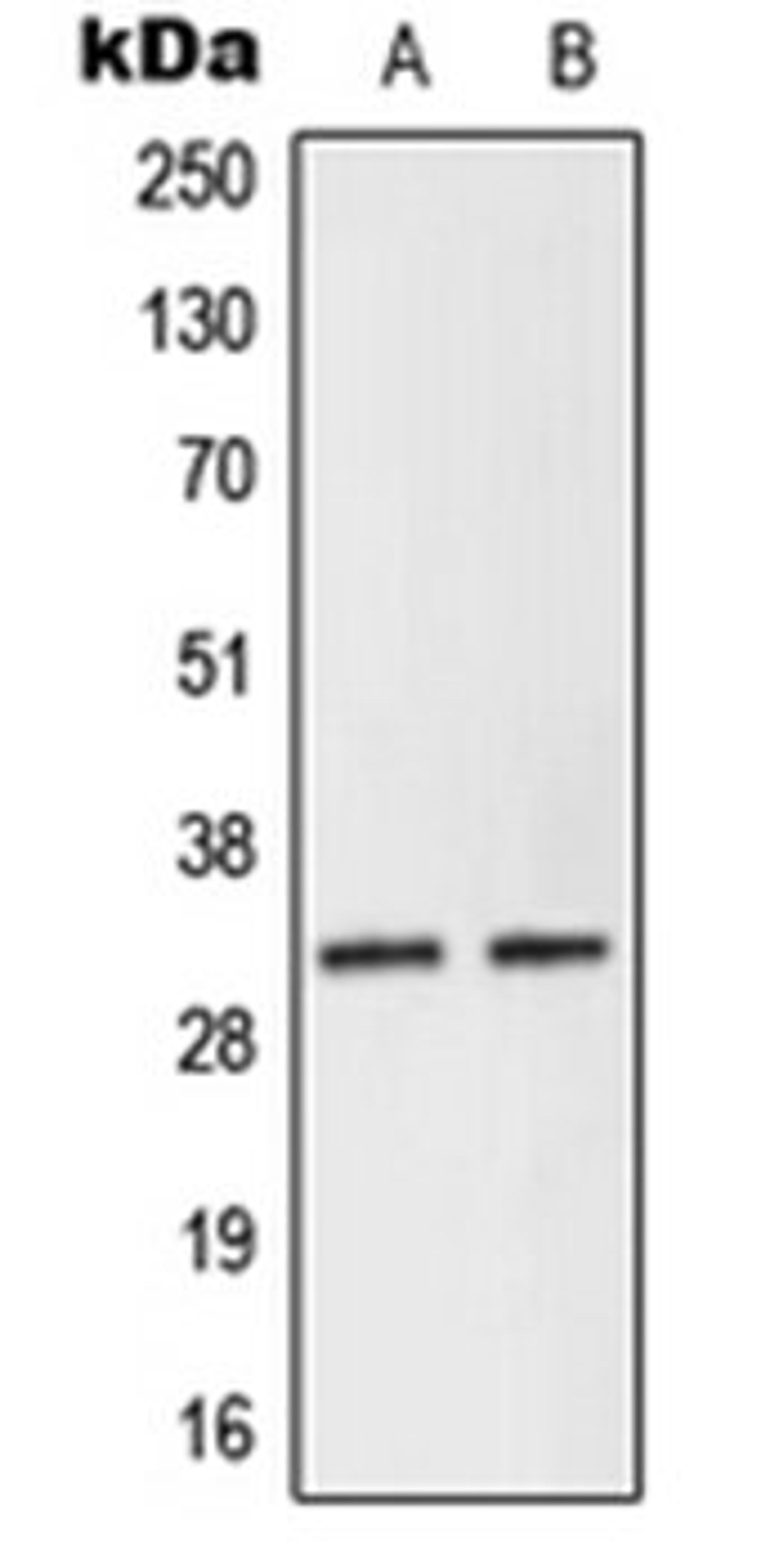 Western blot analysis of Human Placenta (Lane 1), KNRK (Lane 2) whole cell lysates using NEURL2 antibody