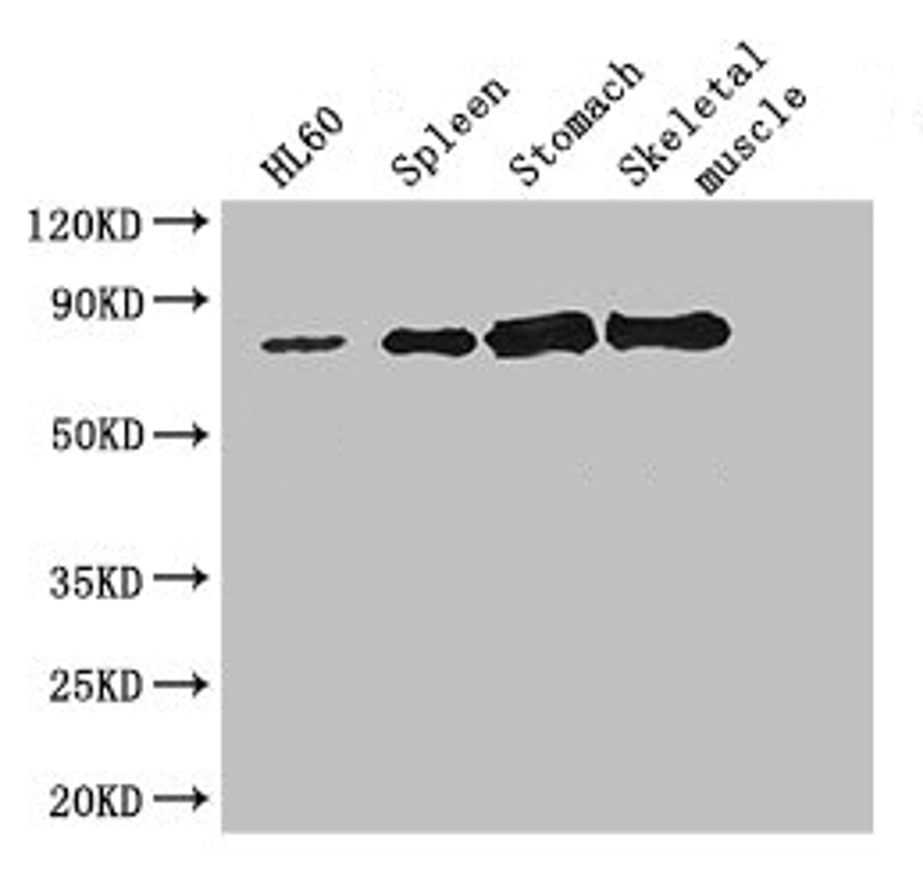 Western Blot. Positive WB detected in: Hela whole cell lysate, HL60 whole cell lysate, Jurkat whole cell lysate, Mouse heart tissue, Mouse brain tissue, Mouse spleen tissue, Mouse stomach tissue, Mouse skeletal muscle tissue. All lanes: SENP1 antibody at 2.7ug/ml. Secondary. Goat polyclonal to rabbit IgG at 1/50000 dilution. Predicted band size: 74 kDa. Observed band size: 74, 50 kDa.
