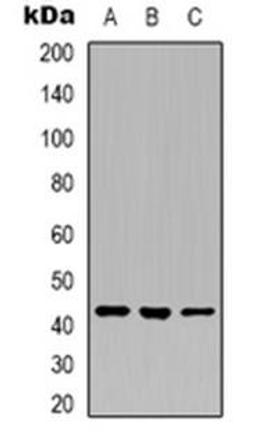 Western blot analysis of Layilin expression in U251 (Lane 1), K562 (Lane 2), A549 (Lane 3) whole cell lysates using LAYN antibody