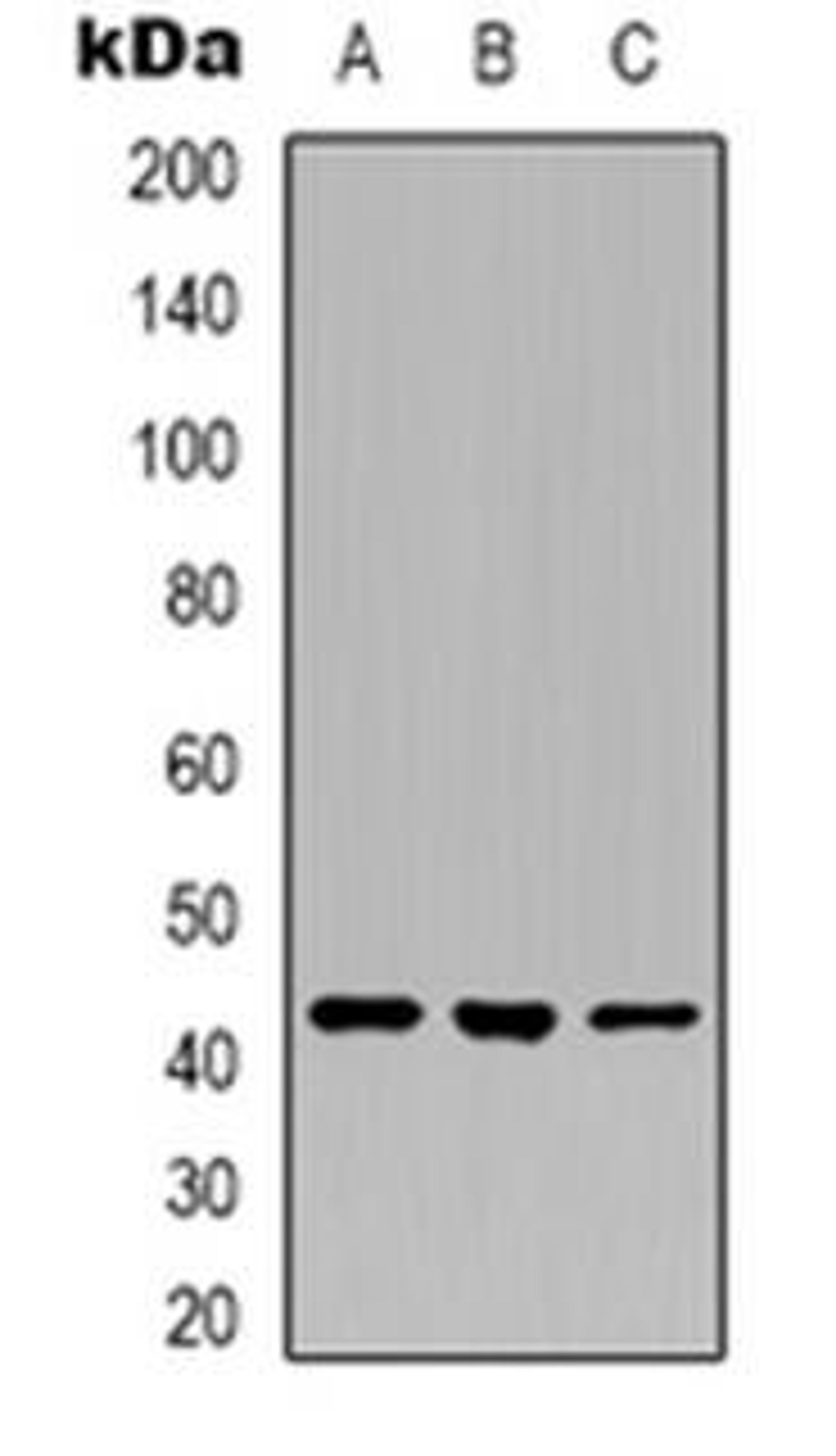 Western blot analysis of Layilin expression in U251 (Lane 1), K562 (Lane 2), A549 (Lane 3) whole cell lysates using LAYN antibody