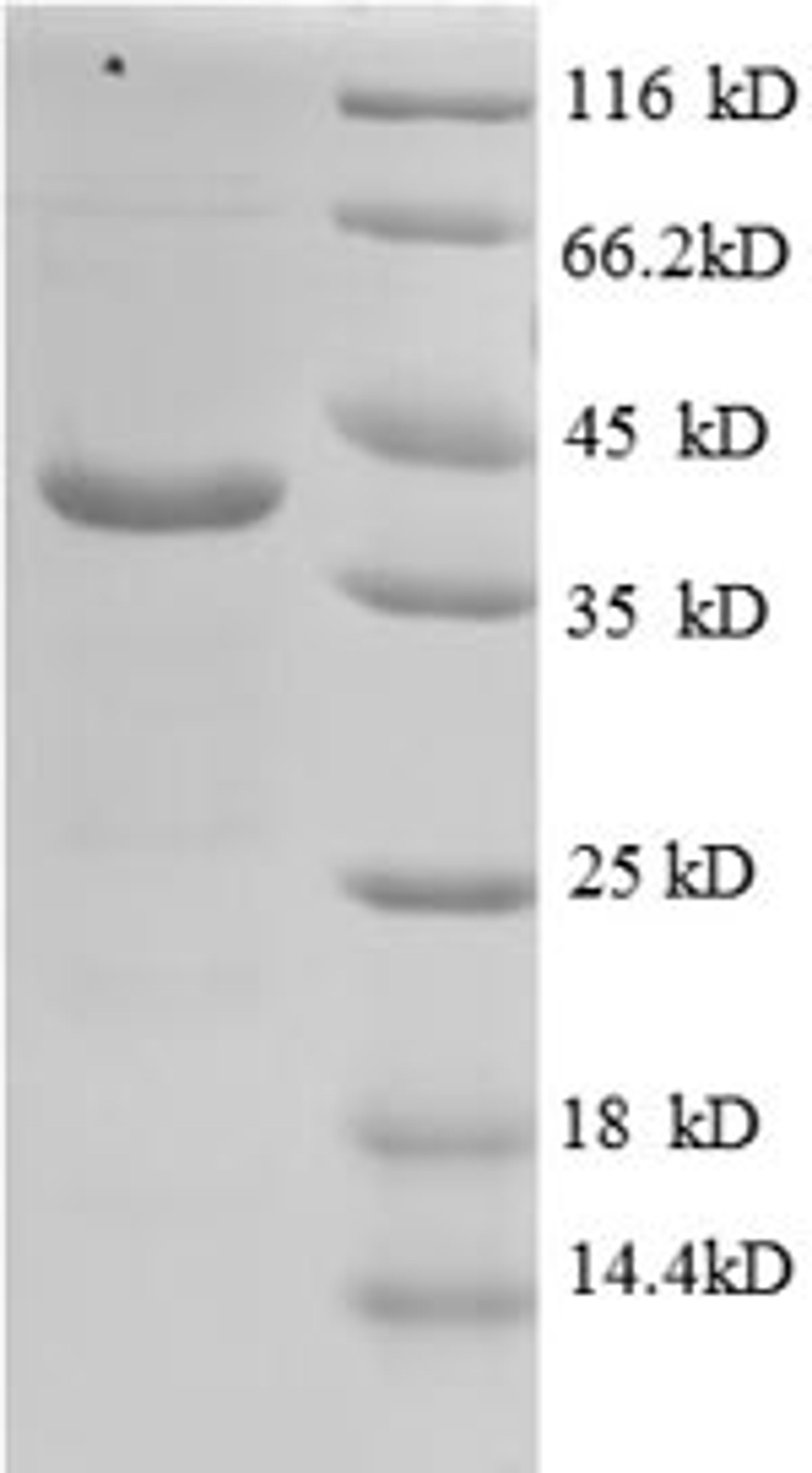 (Tris-Glycine gel) Discontinuous SDS-PAGE (reduced) with 5% enrichment gel and 15% separation gel.