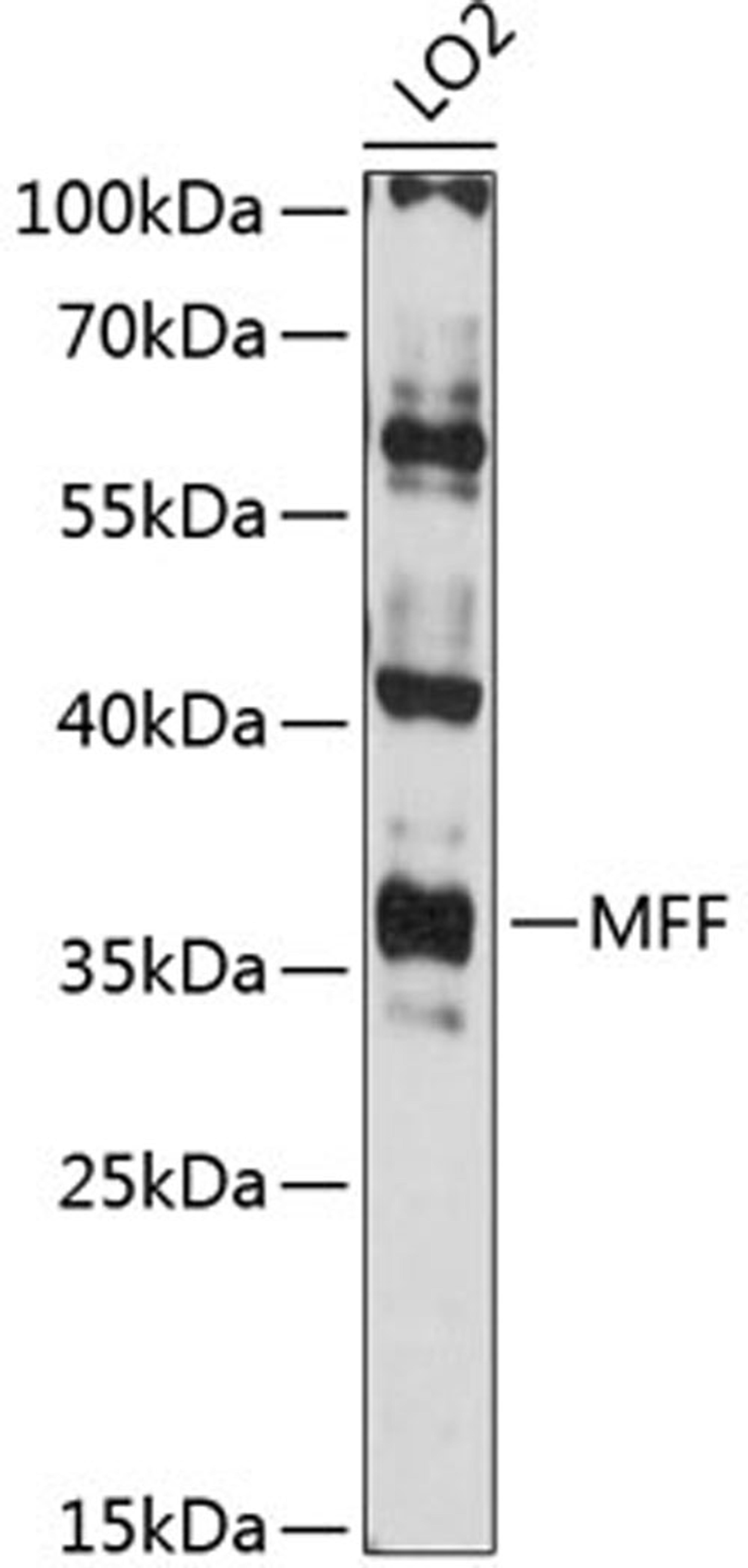 Western blot - MFF antibody (A12392)