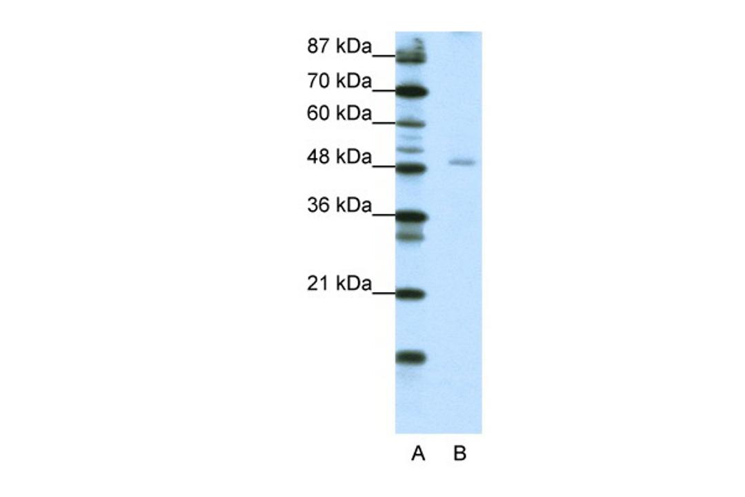 Antibody used in WB on Transfected 293T at 1.25 ug/ml.