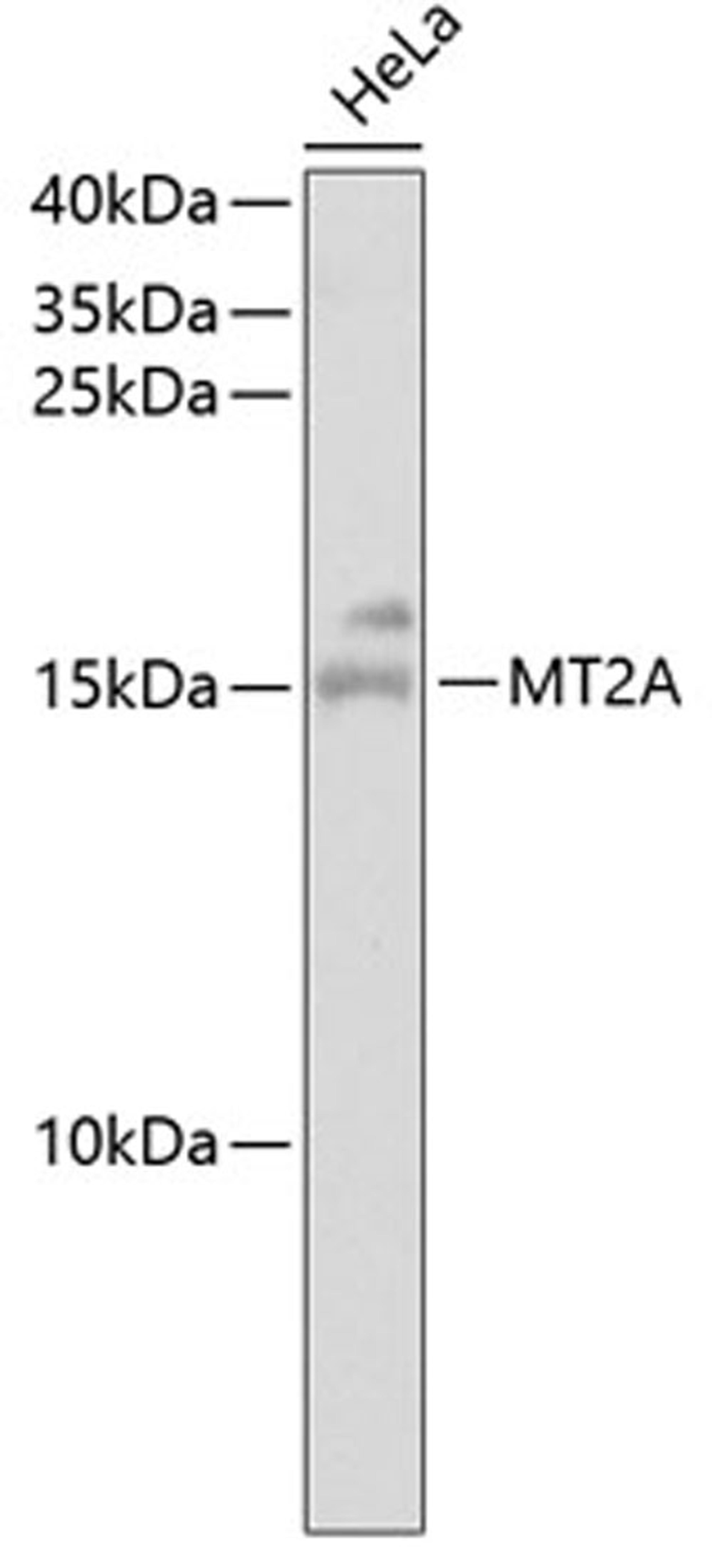 Western blot - MT2A antibody (A2018)