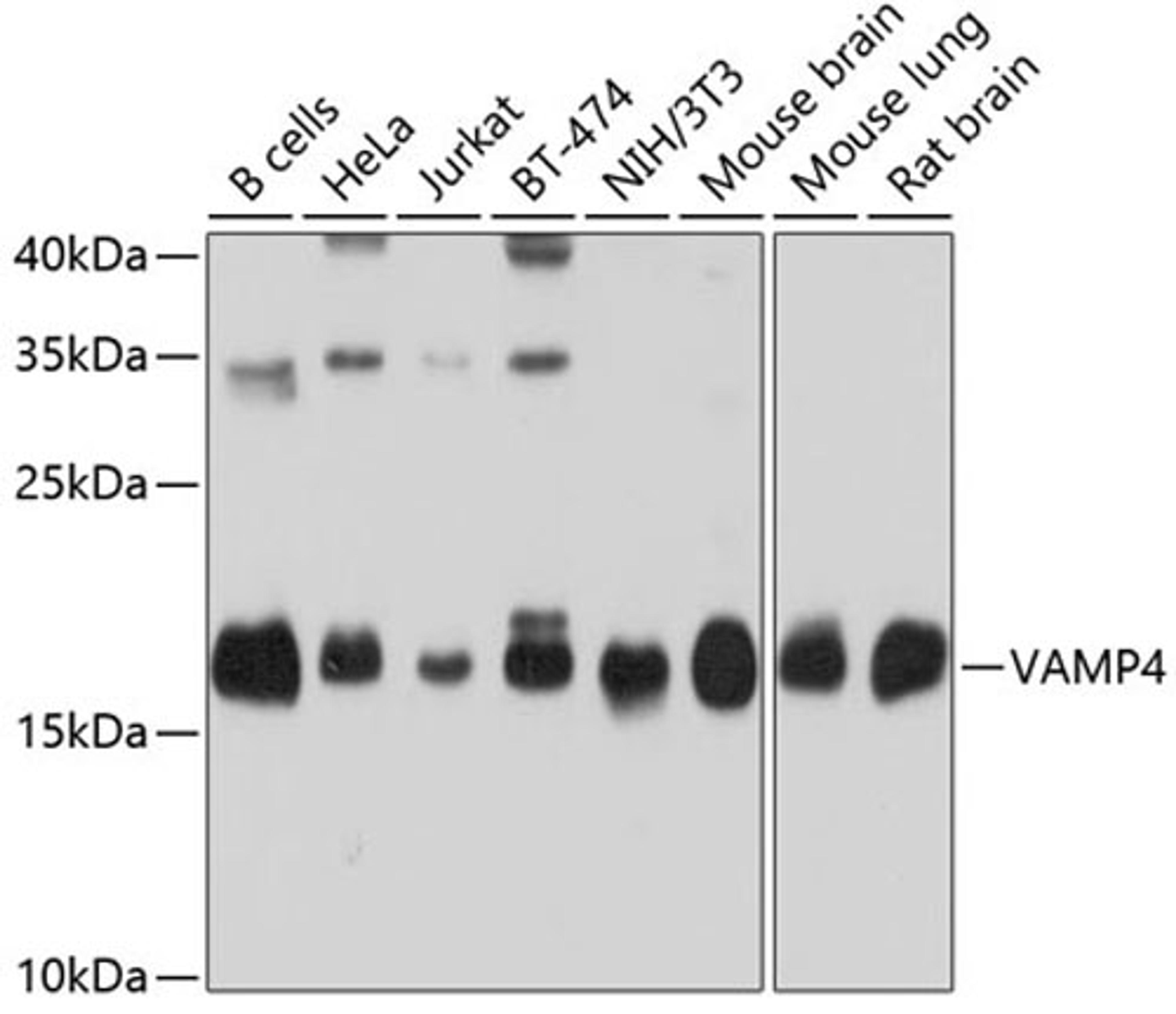 Western blot - VAMP4 antibody (A4241)