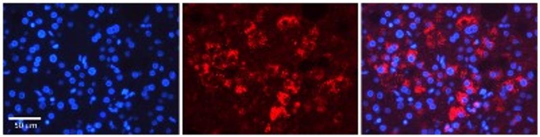 Immunocytochemistry/Immunofluorescence: Tapasin Antibody [NBP1-59071] - Human Adult liver Observed Staining: Cytoplasmic Primary Antibody Concentration: 1 : 600 Secondary Antibody: Donkey anti-Rabbit-Cy2/3 Secondary Antibody Concentration: 1 : 200 Magnification: 20X Exposure Time: 0.5 2.0 secProtocol located in Reviews and Data.