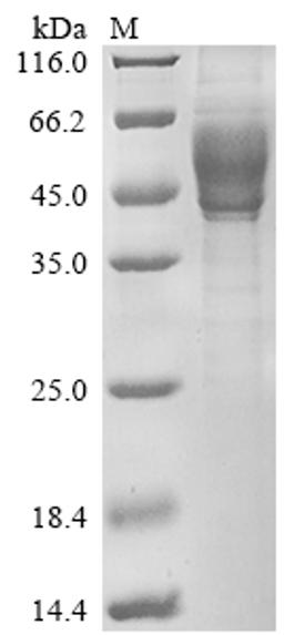 (Tris-Glycine gel) Discontinuous SDS-PAGE (reduced) with 5% enrichment gel and 15% separation gel.