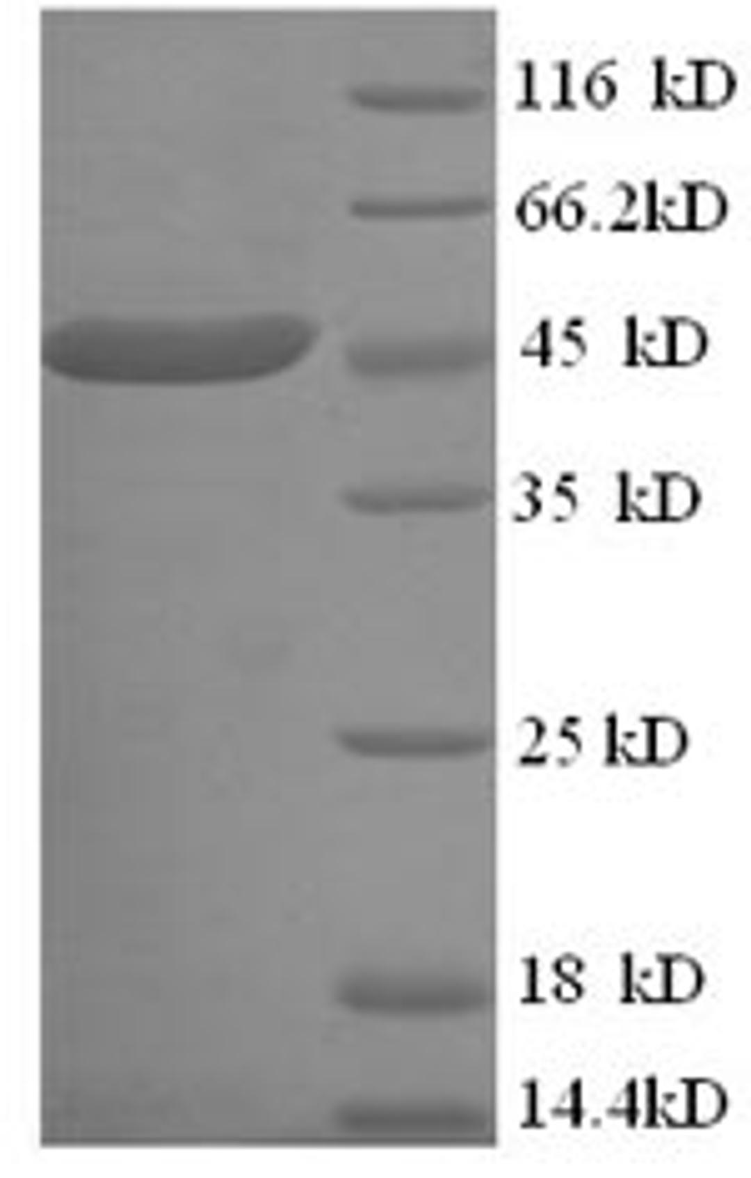 (Tris-Glycine gel) Discontinuous SDS-PAGE (reduced) with 5% enrichment gel and 15% separation gel.