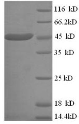 (Tris-Glycine gel) Discontinuous SDS-PAGE (reduced) with 5% enrichment gel and 15% separation gel.