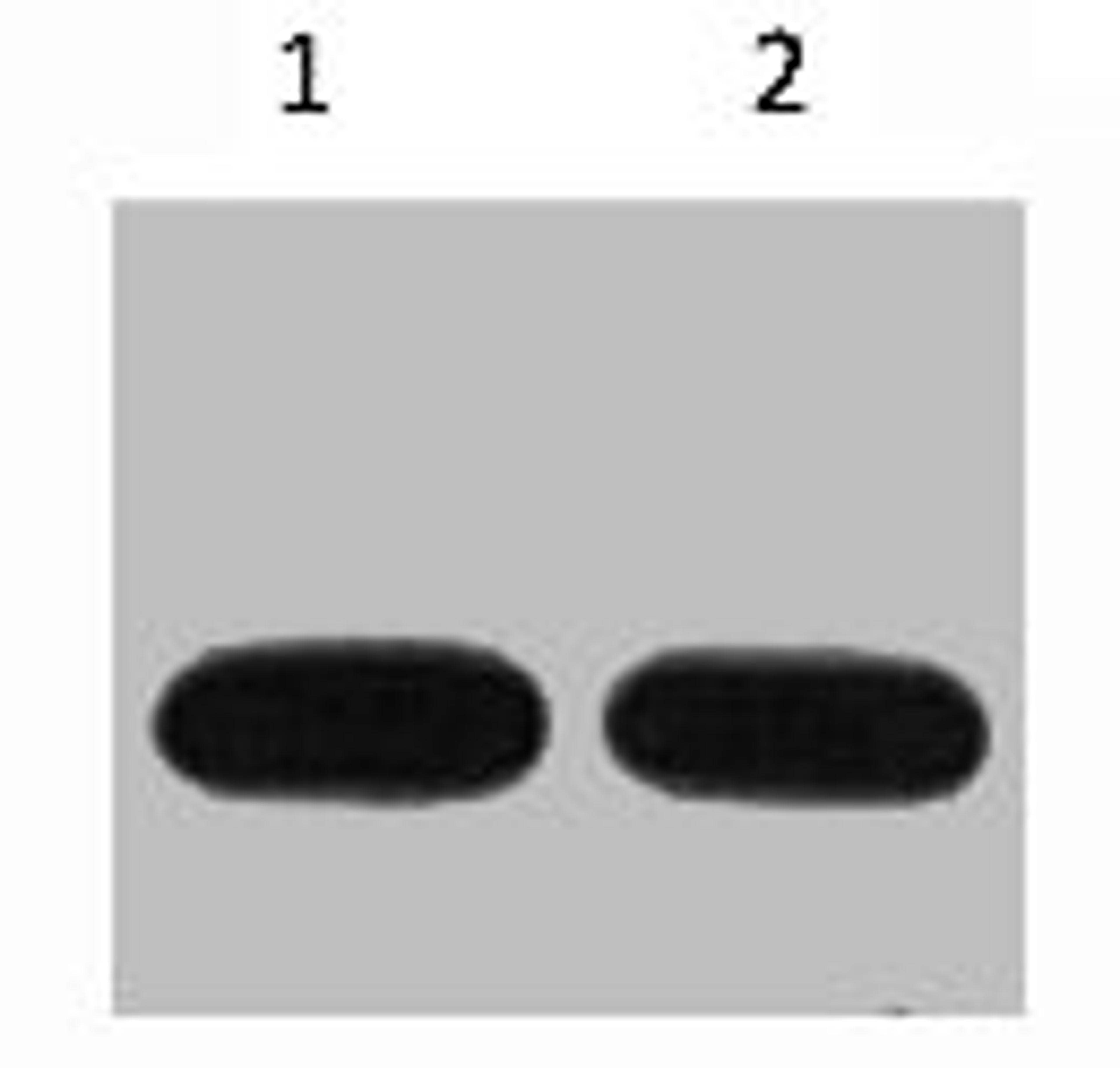 Western blot analysis of Avi-Recombinant protein, diluted at 1) 1:5000 2) 1:10000