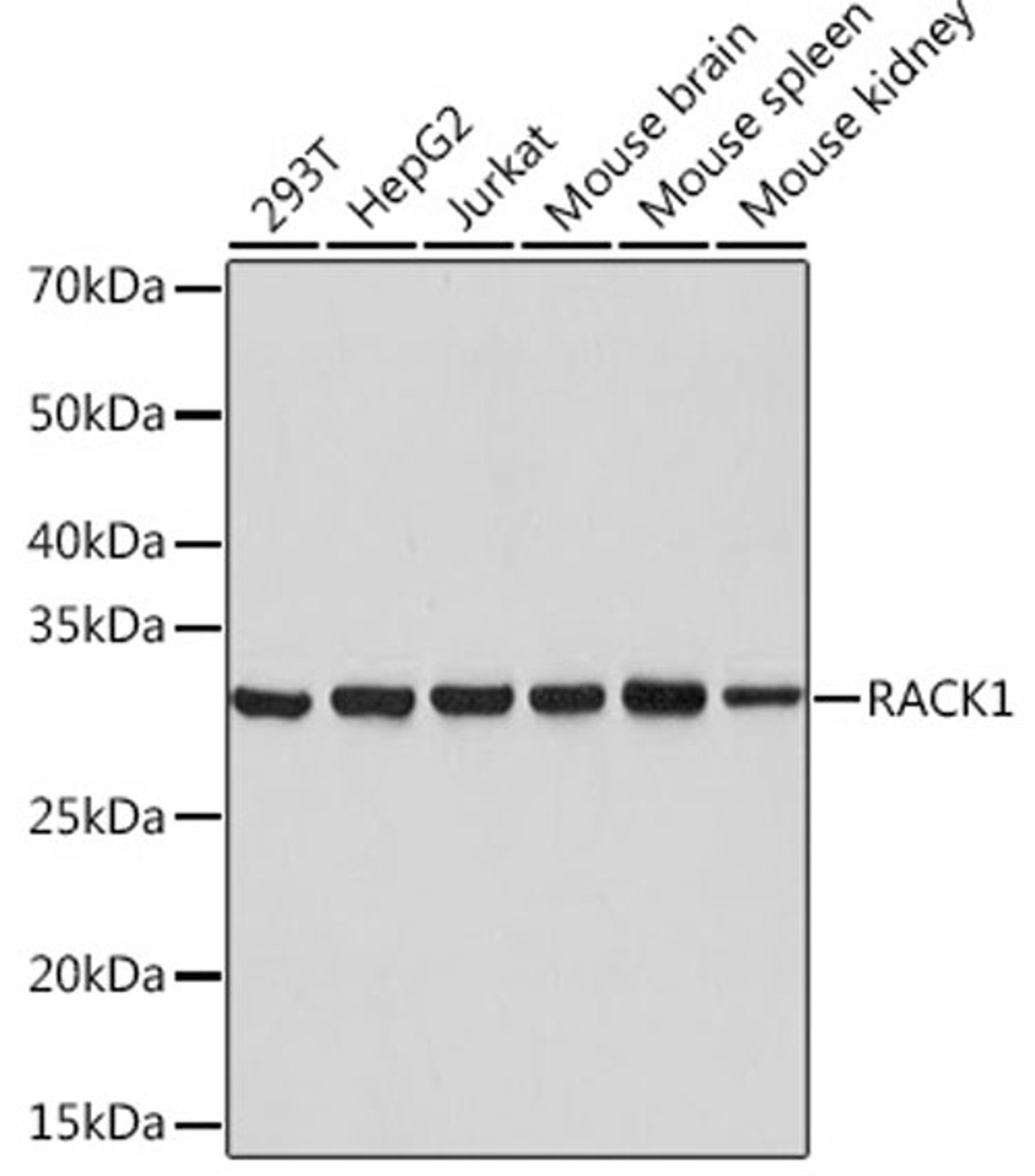 Western blot - RACK1 Rabbit mAb (A3808)