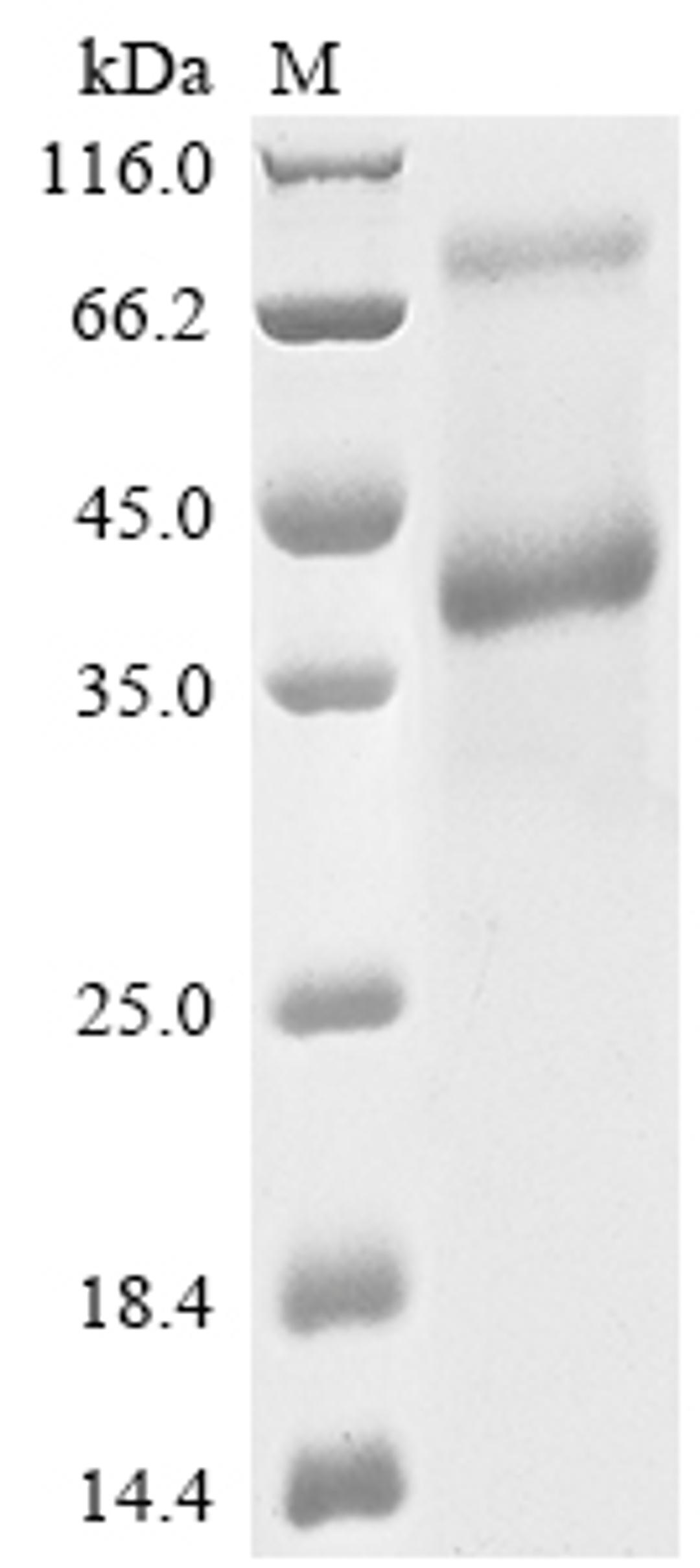 (Tris-Glycine gel) Discontinuous SDS-PAGE (reduced) with 5% enrichment gel and 15% separation gel.