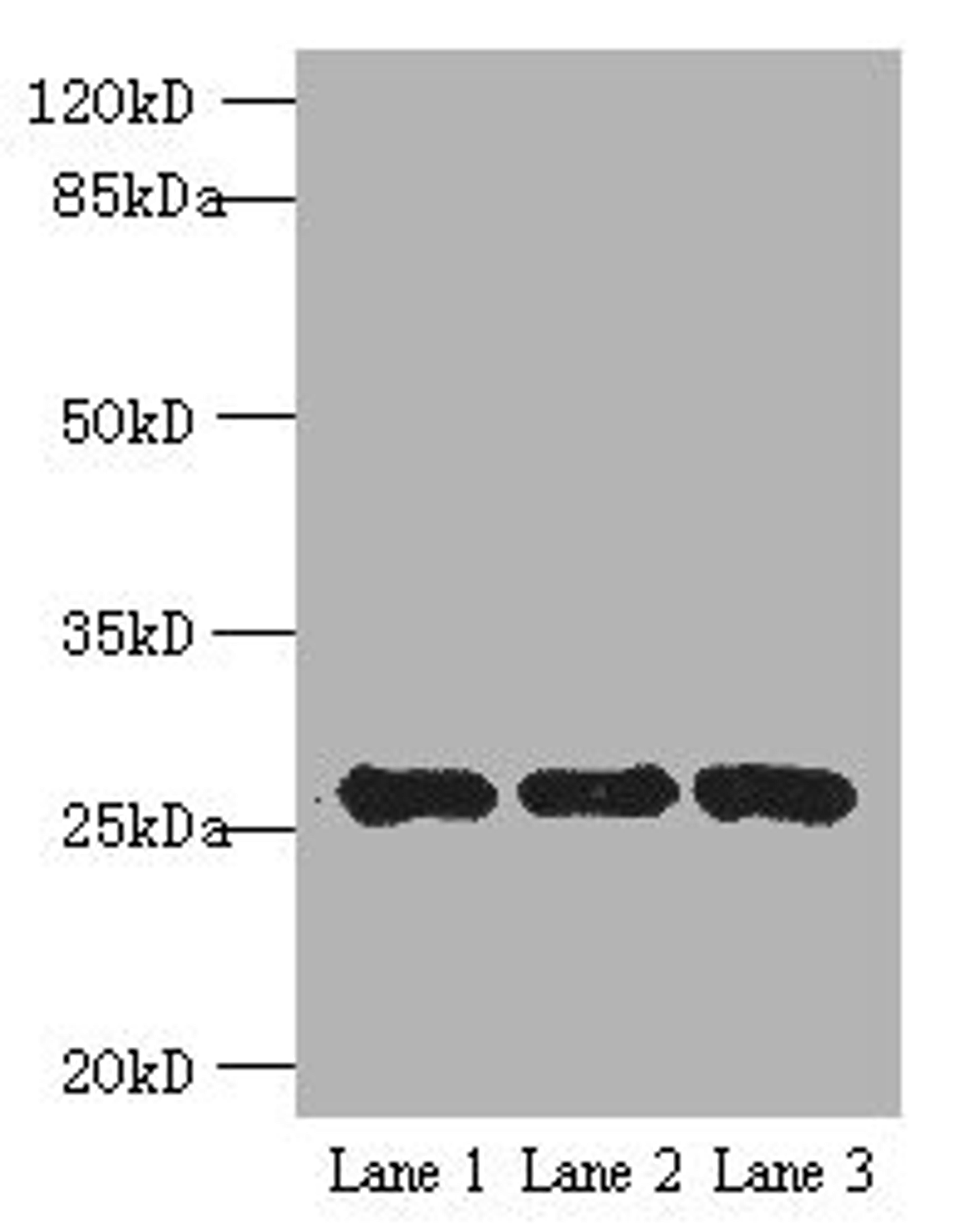 Western blot. All lanes: EXOSC5 antibody at 5ug/ml. Lane 1: K562 whole cell lysate. Lane 2: 293T whole cell lysate. Lane 3: Hela whole cell lysate. Secondary. Goat polyclonal to rabbit IgG at 1/10000 dilution. Predicted band size: 25 kDa. Observed band size: 25 kDa.