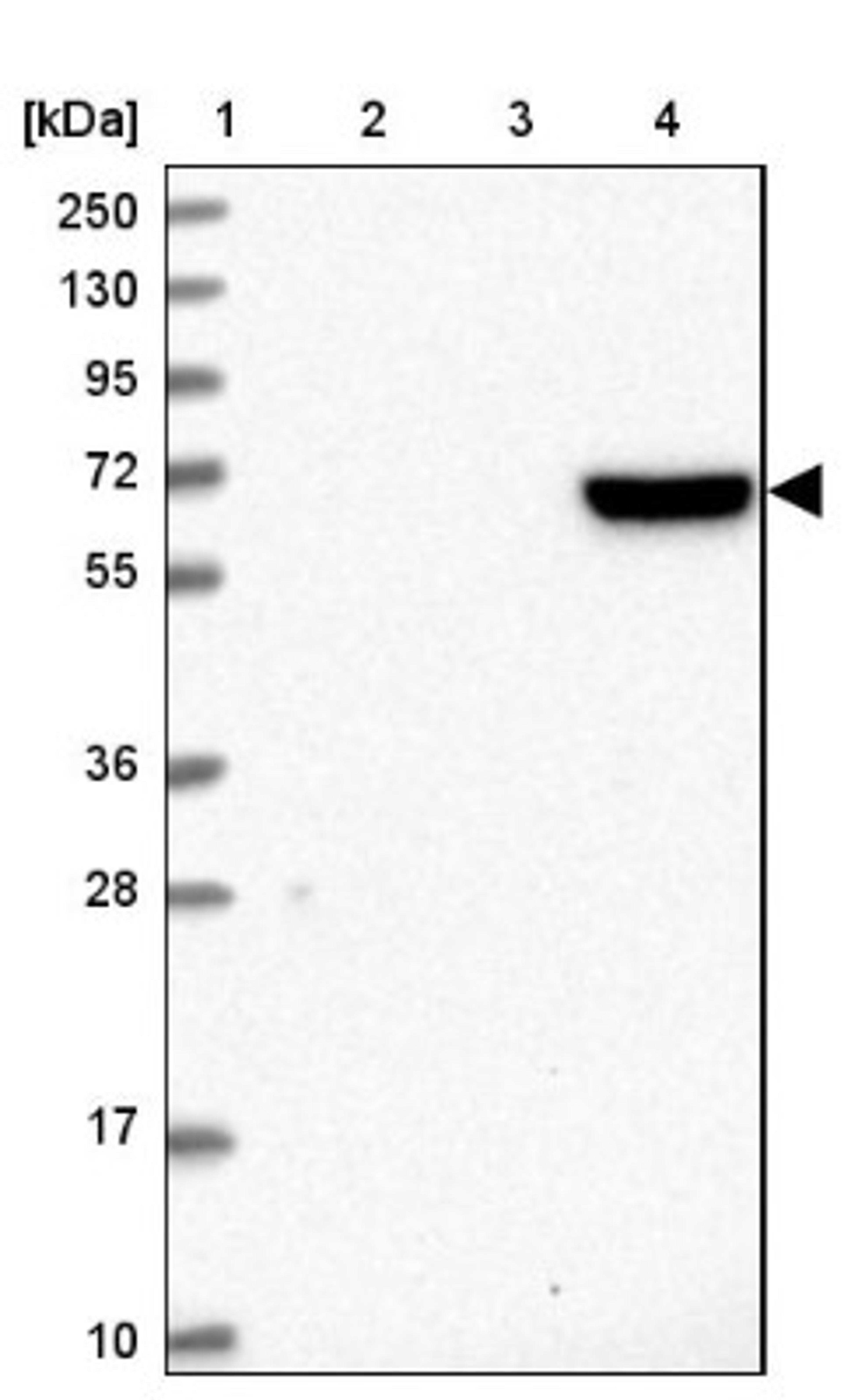 Western Blot: LAS2 Antibody [NBP1-91719] - Lane 1: Marker [kDa] 250, 130, 95, 72, 55, 36, 28, 17, 10<br/>Lane 2: Human cell line RT-4<br/>Lane 3: Human cell line U-251MG sp<br/>Lane 4: Human plasma (IgG/HSA depleted)