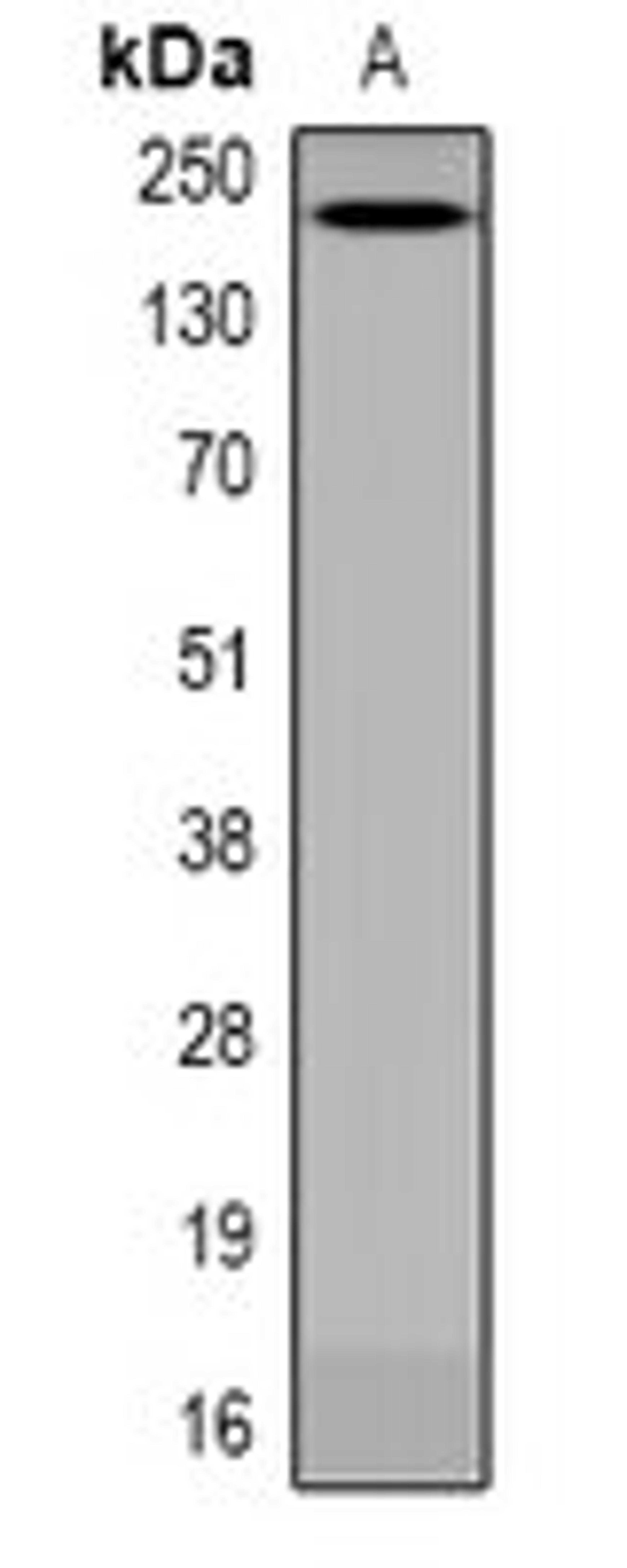 Western blot analysis of HEK293 LPS-treated (Lane1) whole cell lysates using ANAPC1 antibody