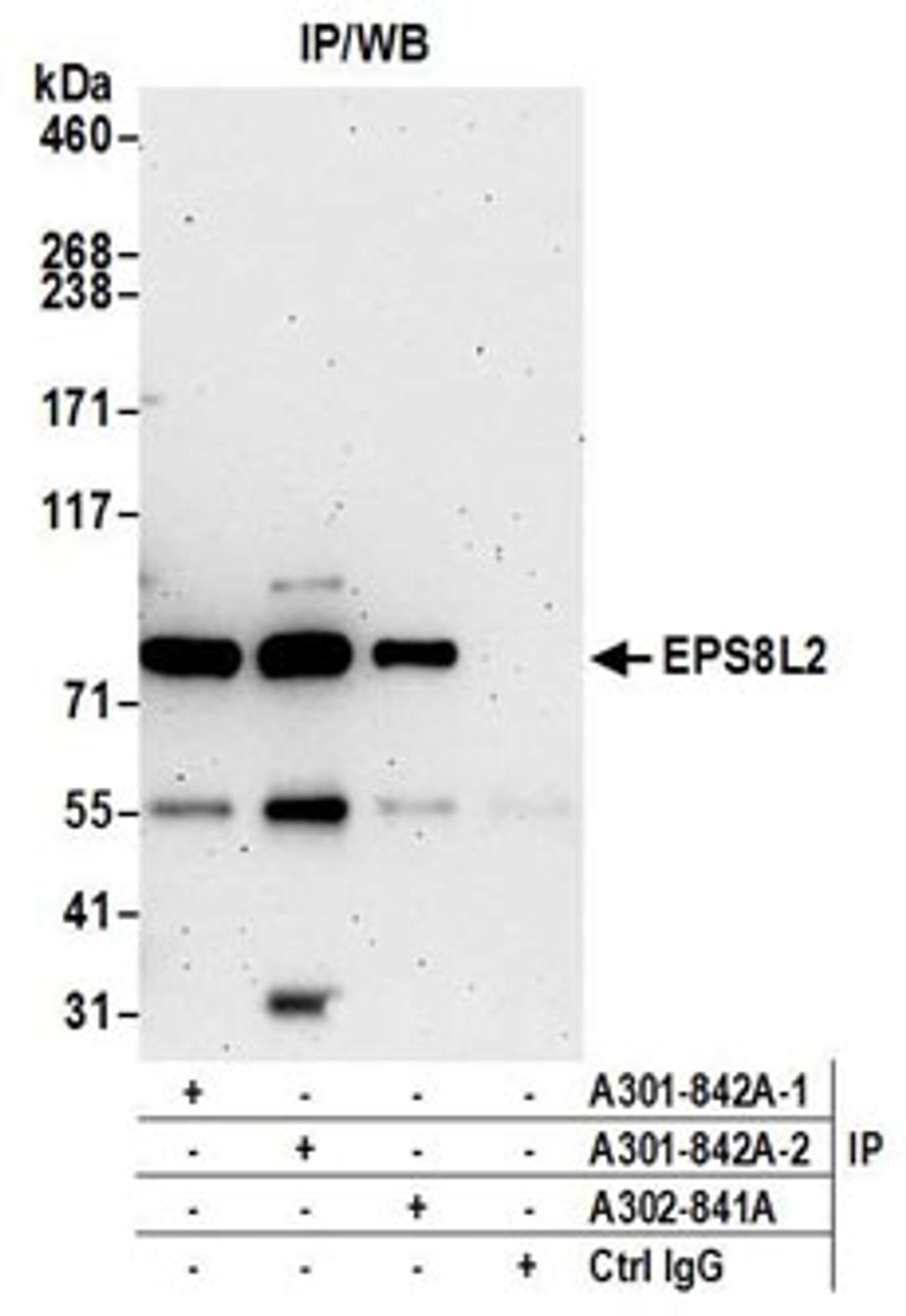 Detection of human EPS8L2 by western blot of immunoprecipitates.