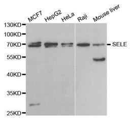 Western blot analysis of extracts of various cell lines using SELE antibody