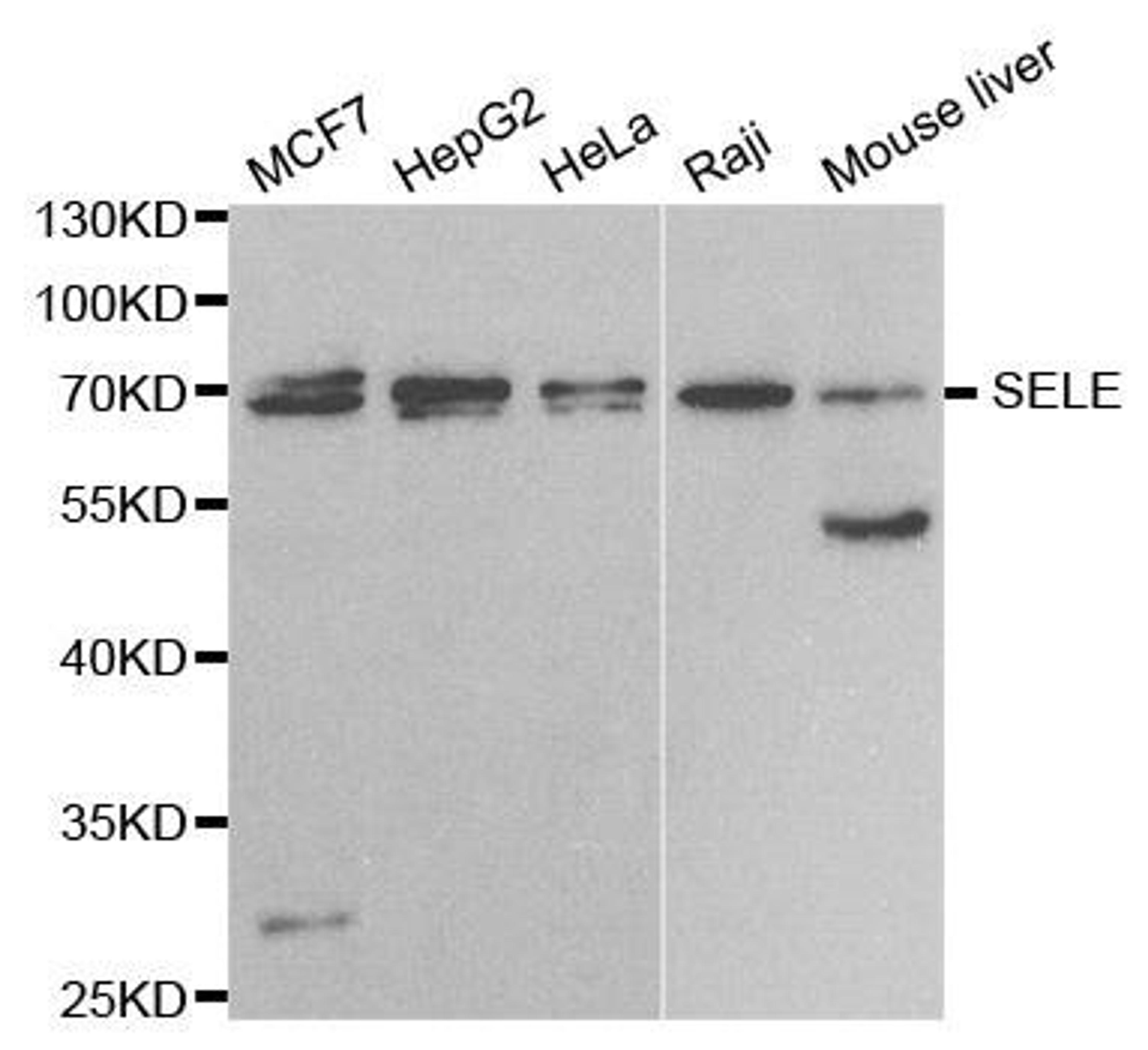 Western blot analysis of extracts of various cell lines using SELE antibody