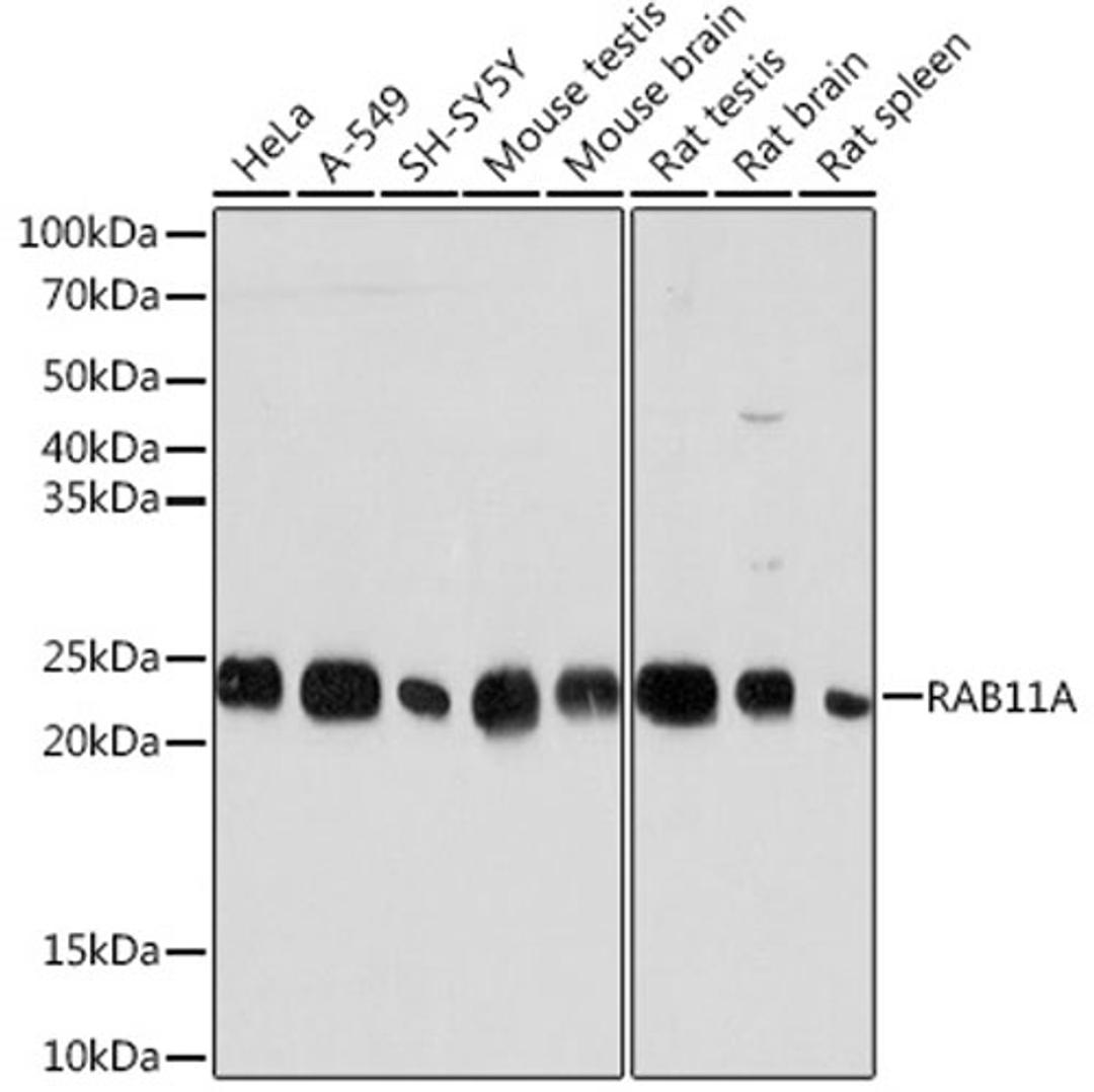 Western blot - RAB11A Rabbit mAb (A3251)