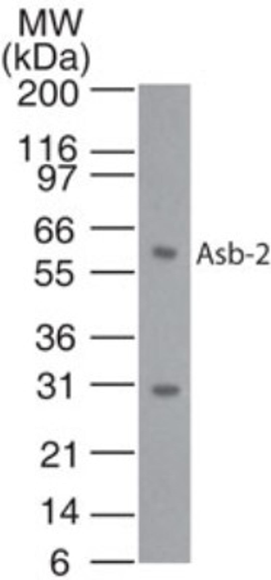 Western Blot: ASB2 Antibody [NB100-56638] - Analysis of Asb-2 in HL60 cell lysate using this antibody at 1:1000 dilution.