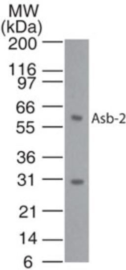 Western Blot: ASB2 Antibody [NB100-56638] - Analysis of Asb-2 in HL60 cell lysate using this antibody at 1:1000 dilution.