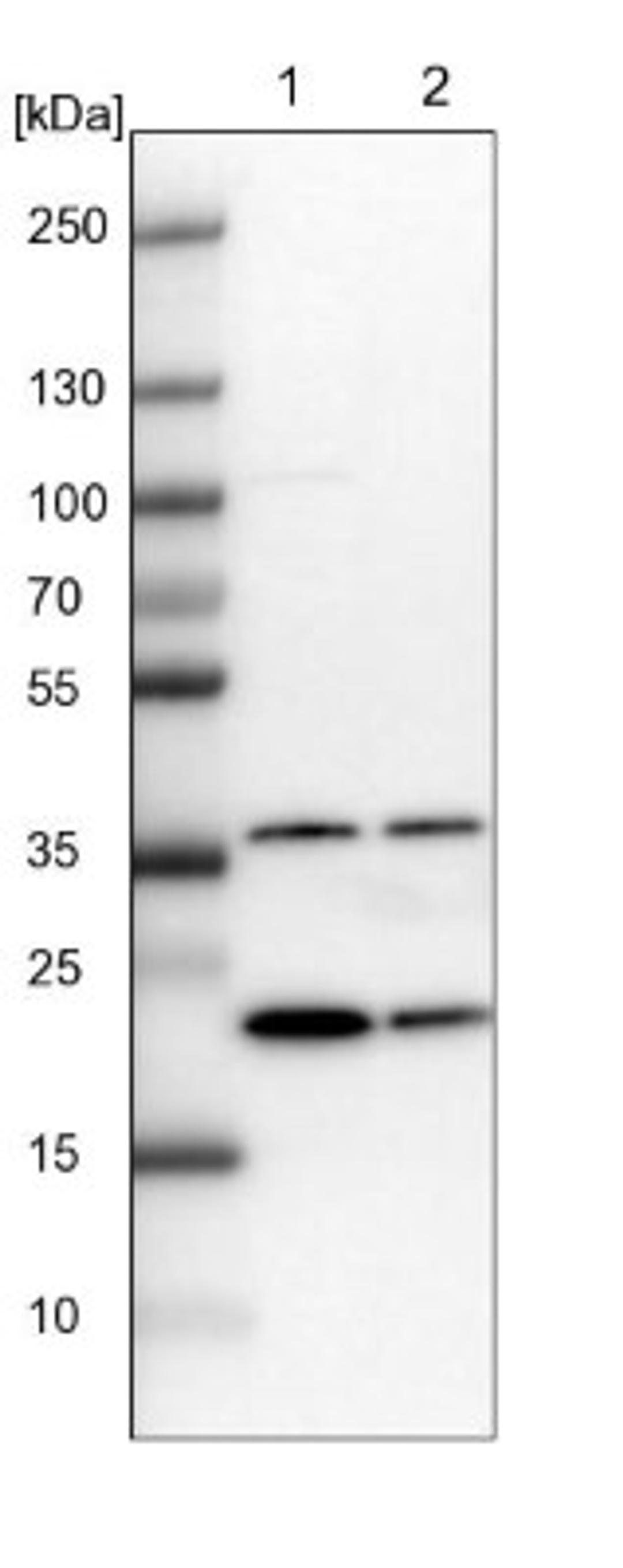 Western Blot: GNPNAT1 Antibody [NBP1-83842] - Lane 1: NIH-3T3 cell lysate (Mouse embryonic fibroblast cells)<br/>Lane 2: NBT-II cell lysate (Rat Wistar bladder tumour cells)