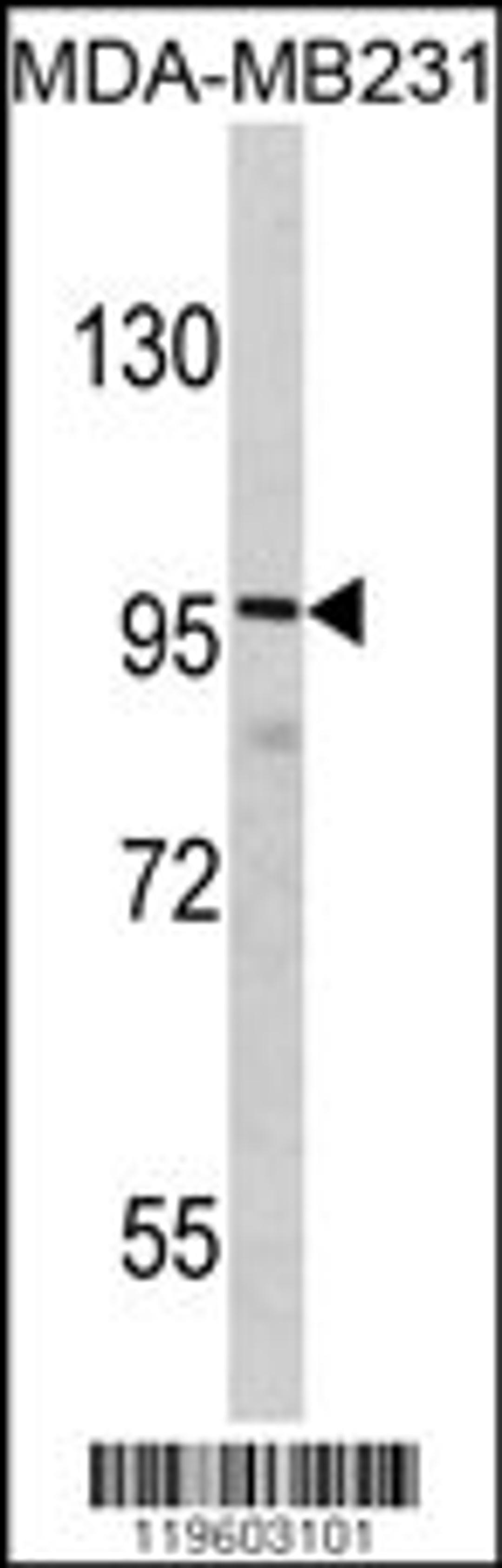 Western blot analysis of DLGAP1 Antibody in MDA-MB231 cell line lysates (35ug/lane)