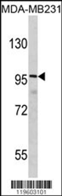 Western blot analysis of DLGAP1 Antibody in MDA-MB231 cell line lysates (35ug/lane)