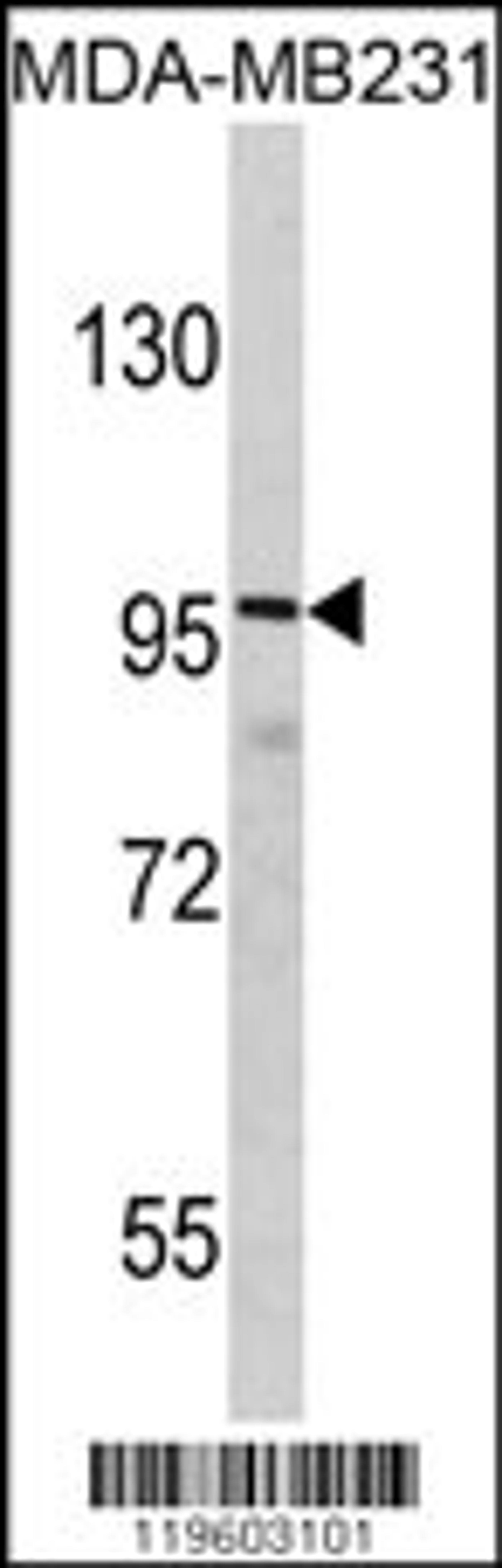 Western blot analysis of DLGAP1 Antibody in MDA-MB231 cell line lysates (35ug/lane)