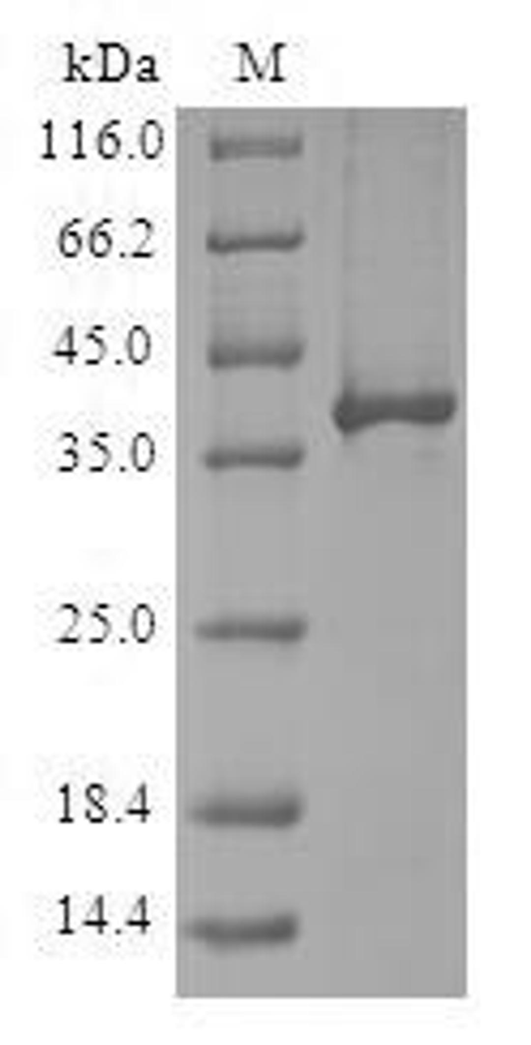 (Tris-Glycine gel) Discontinuous SDS-PAGE (reduced) with 5% enrichment gel and 15% separation gel.