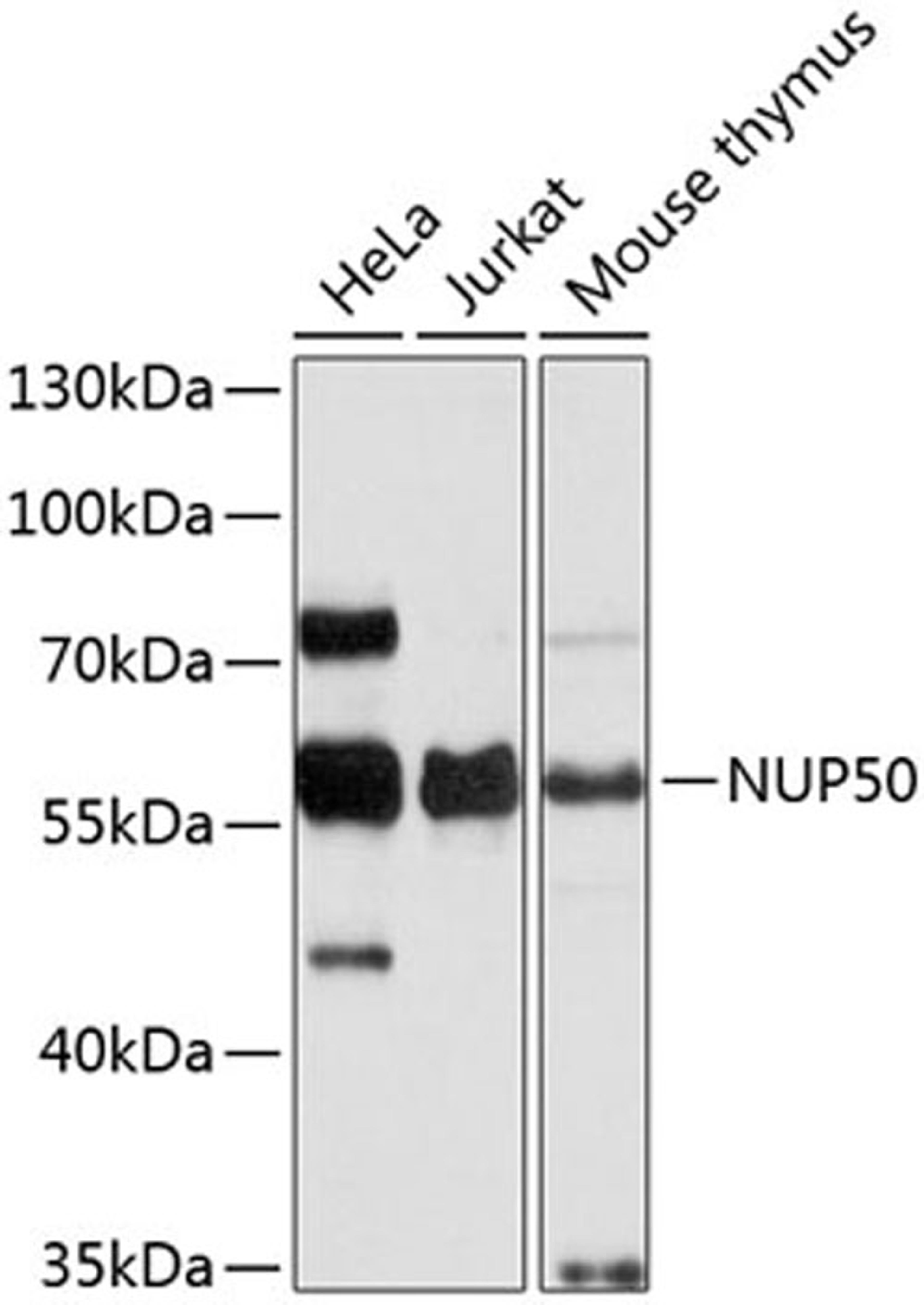 Western blot - NUP50 antibody (A9441)